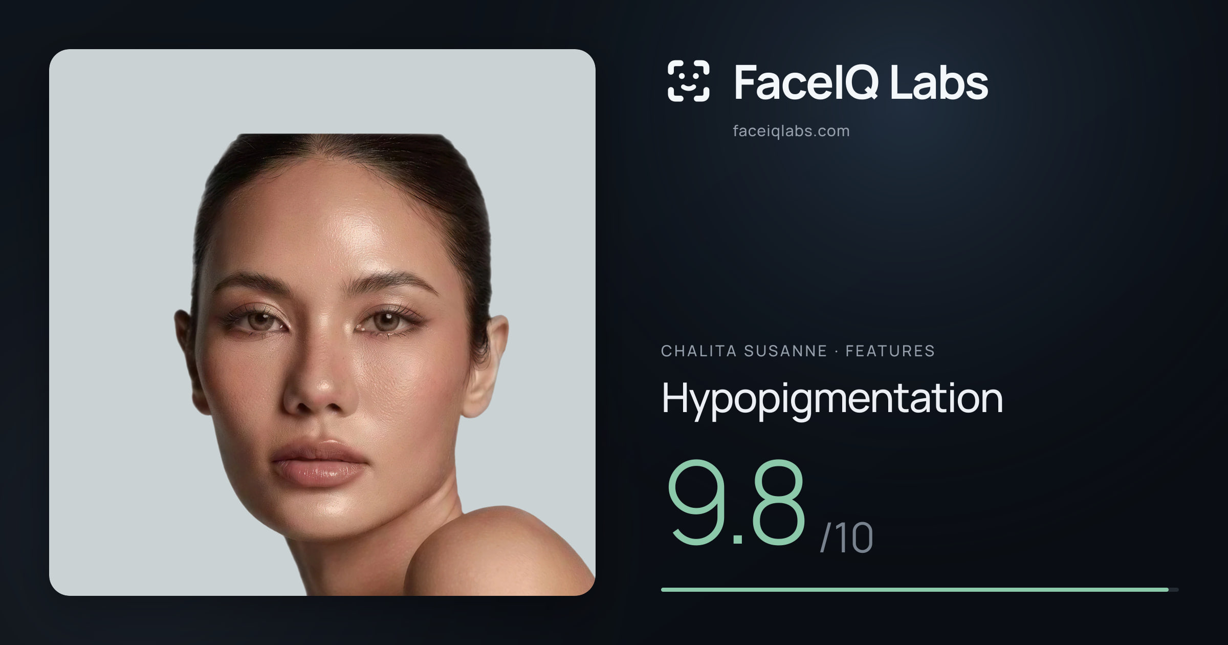 Chalita Susanne Hypopigmentation: 9.8/10, drawn on the photo