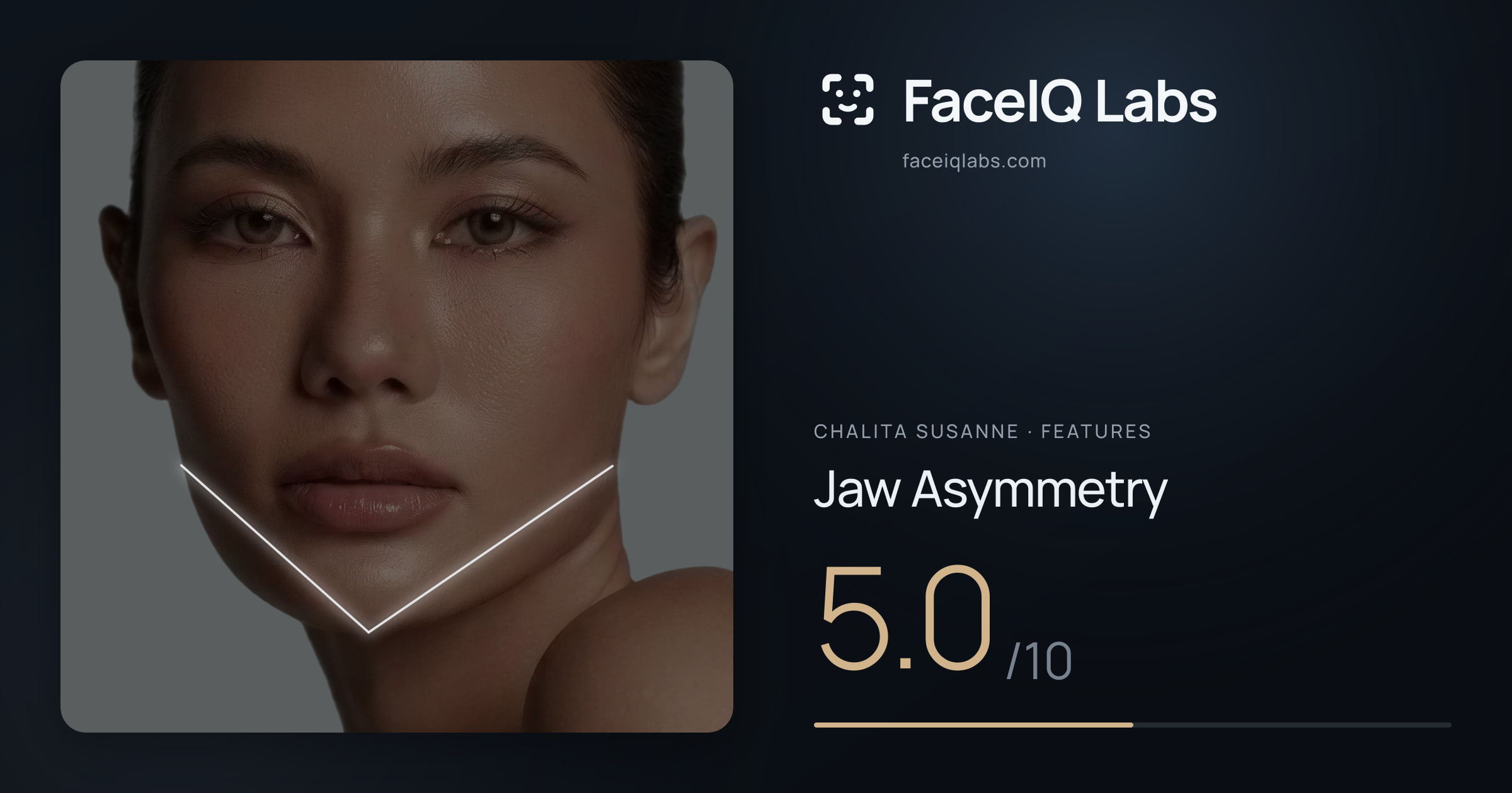 Chalita Susanne Jaw Asymmetry: 5.0/10, drawn on the photo