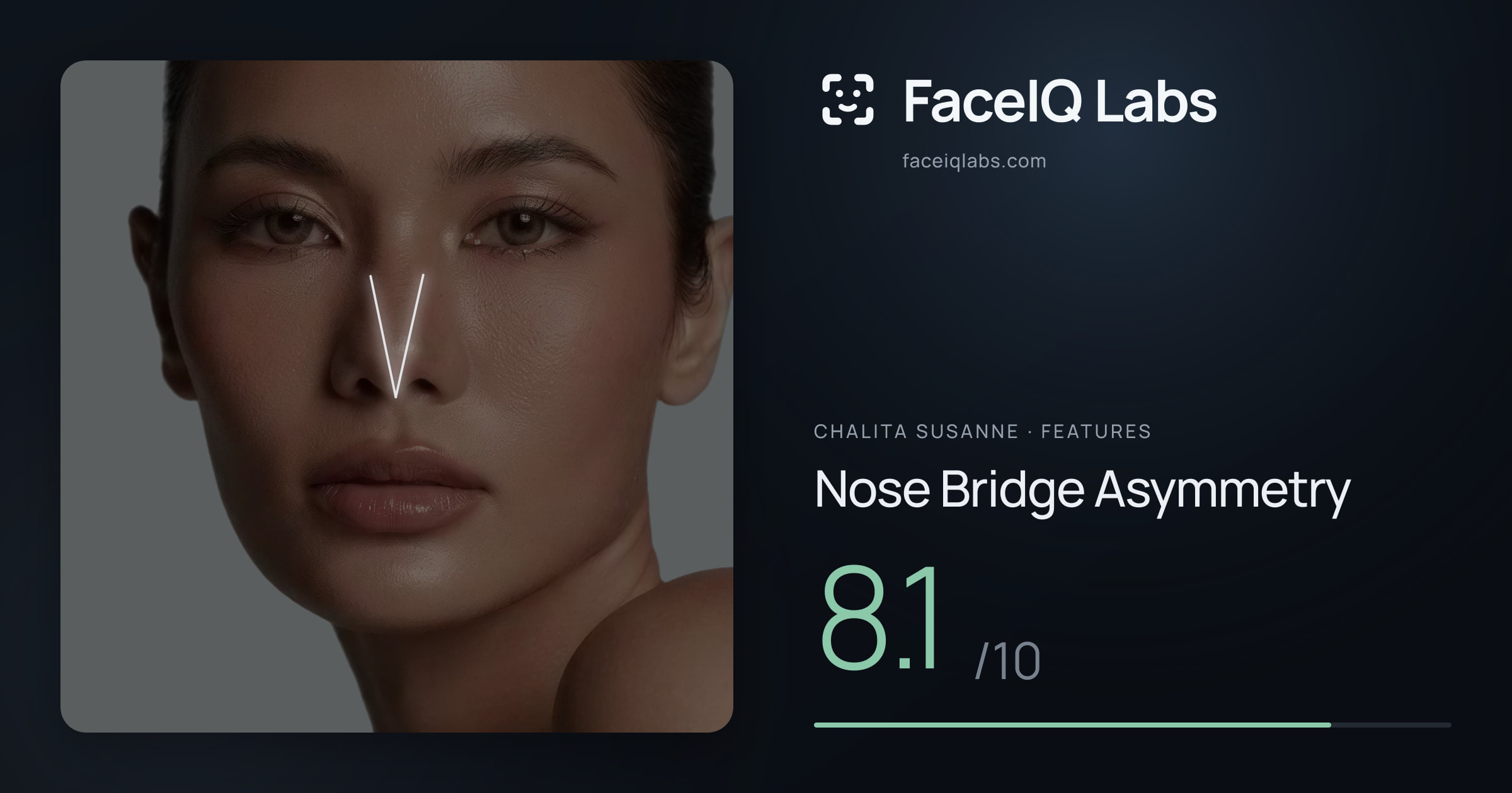 Chalita Susanne Nose Bridge Asymmetry: 8.1/10, drawn on the photo