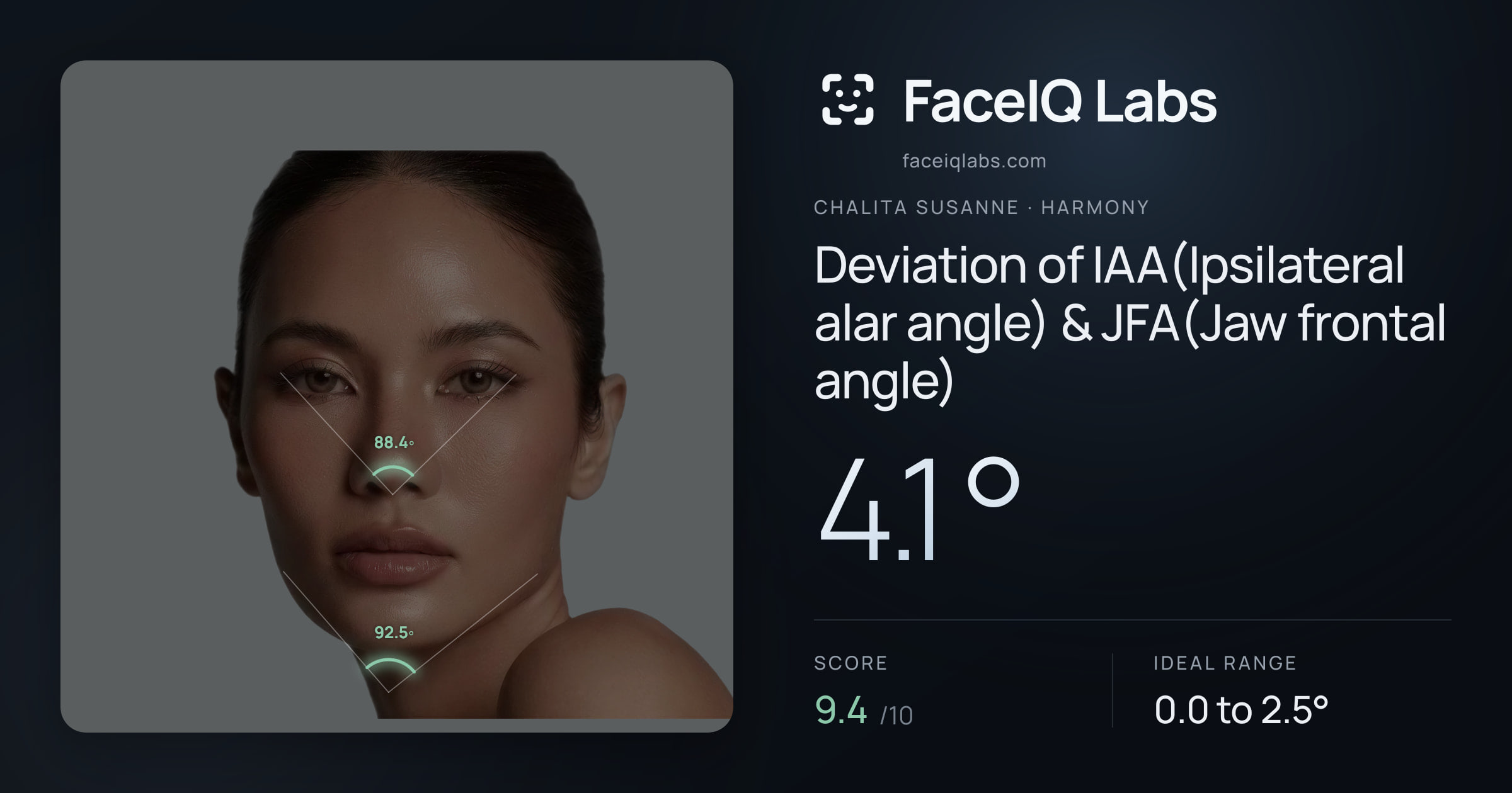 Chalita Susanne Deviation of IAA(Ipsilateral alar angle) & JFA(Jaw frontal angle): 4.1°, drawn on the photo