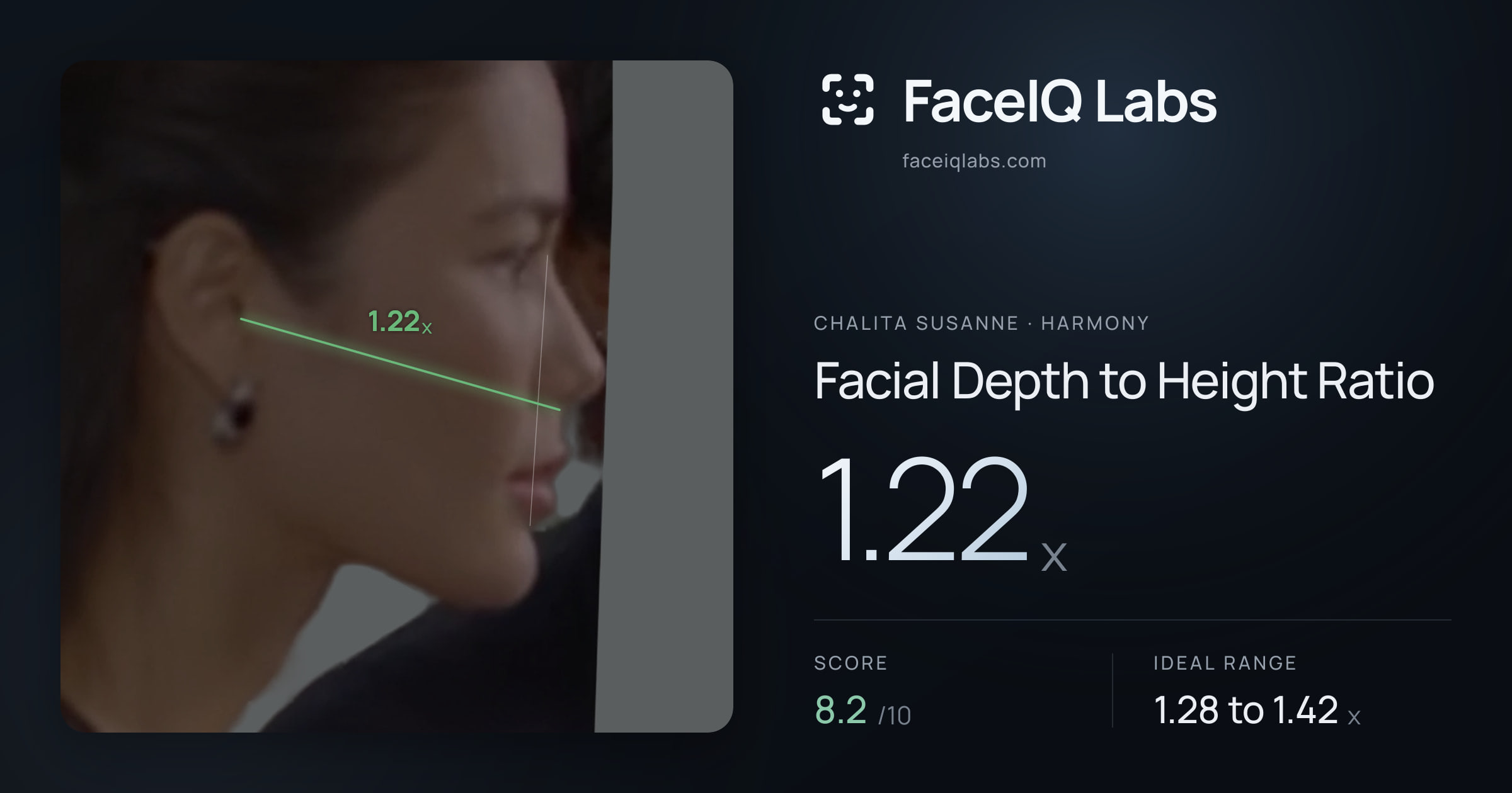 Chalita Susanne Facial Depth to Height Ratio: 1.22x, drawn on the photo