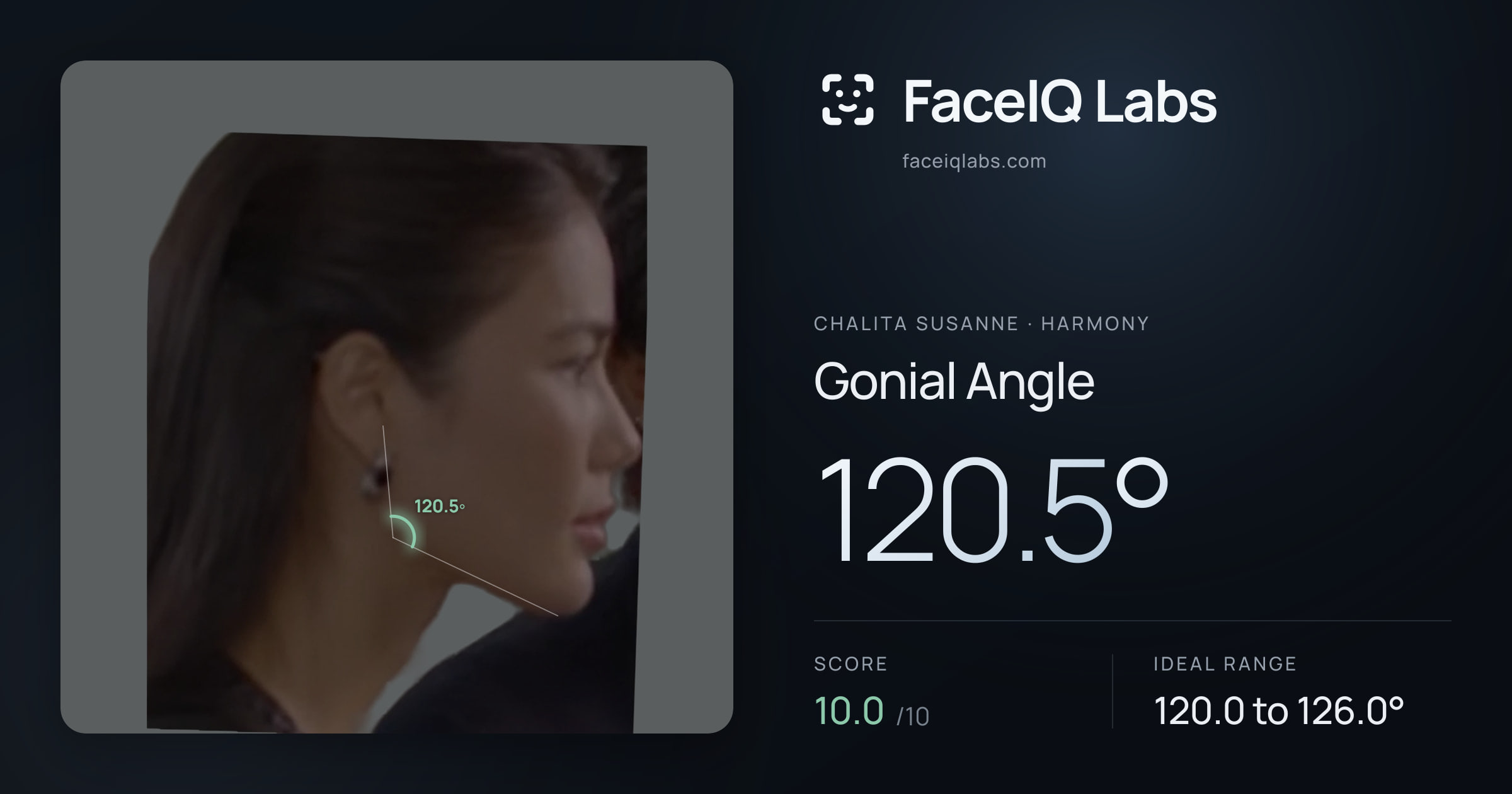 Chalita Susanne Gonial Angle: 120.5°, drawn on the photo