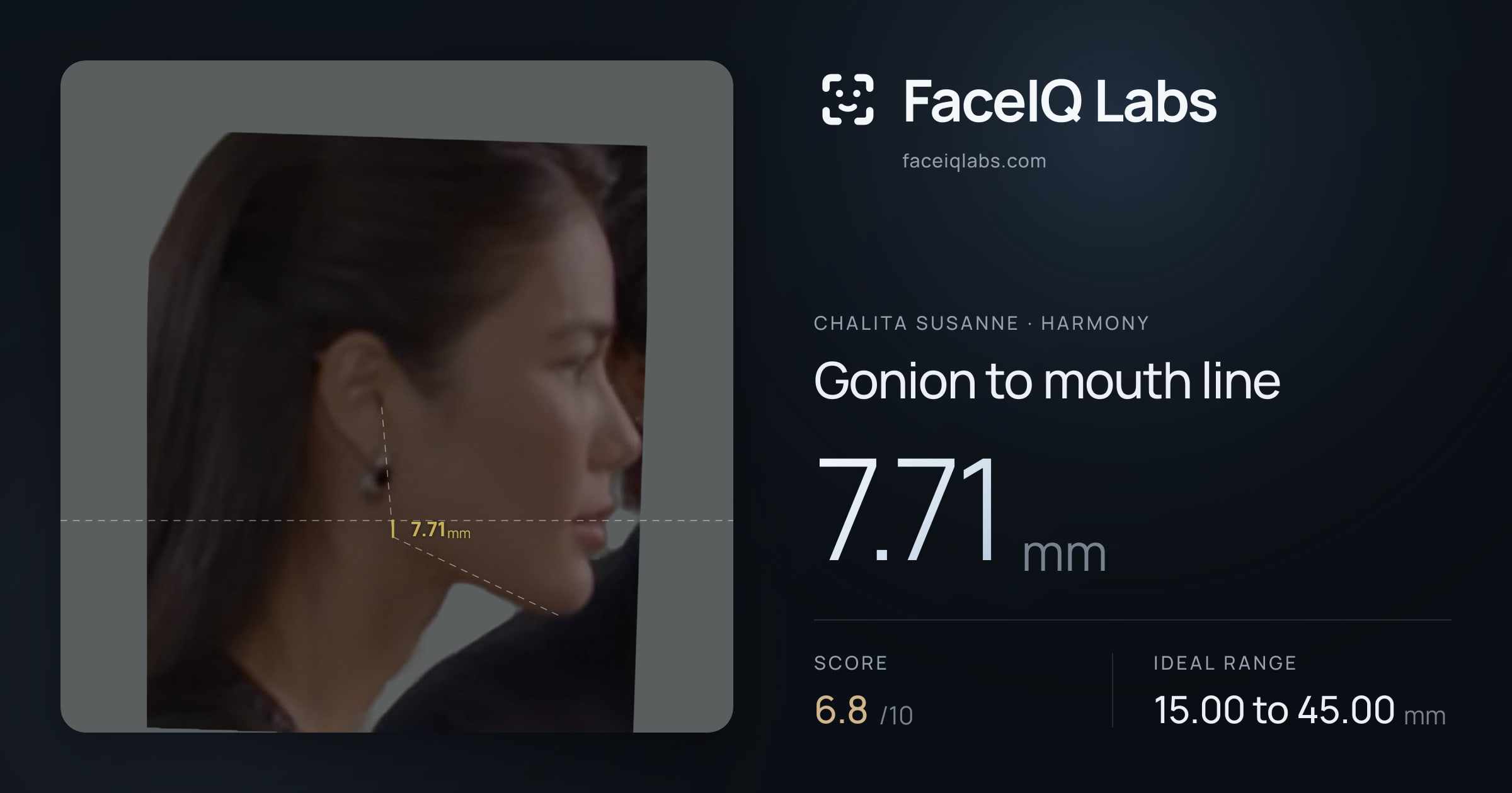Chalita Susanne Gonion to mouth line: 7.71mm, drawn on the photo