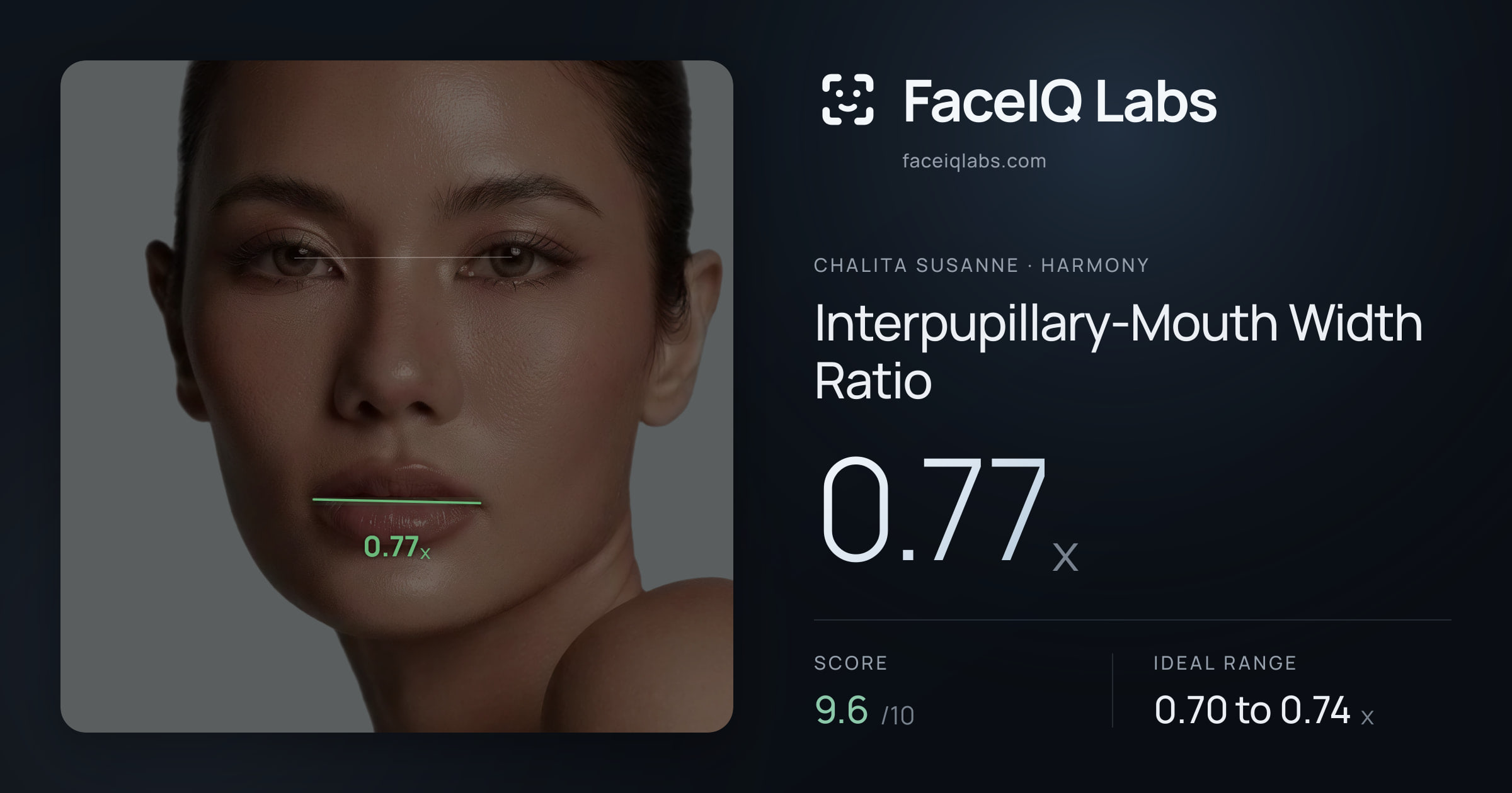 Chalita Susanne Interpupillary-Mouth Width Ratio: 0.77x, drawn on the photo