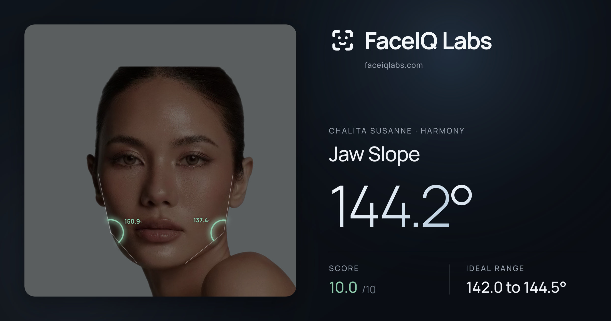 Chalita Susanne Jaw Slope: 144.2°, drawn on the photo
