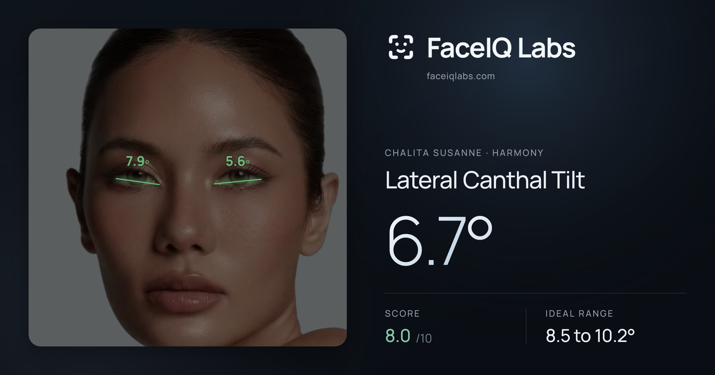 Chalita Susanne Lateral Canthal Tilt: 6.7°, drawn on the photo