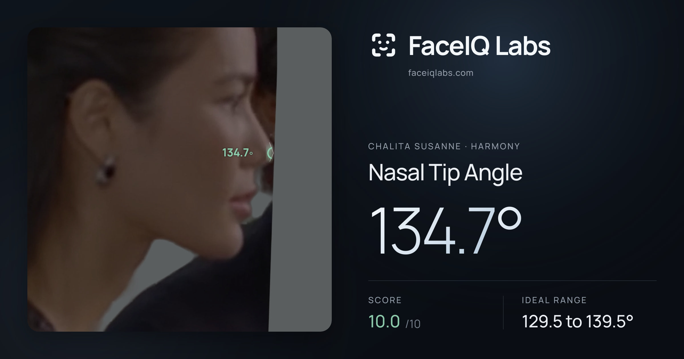 Chalita Susanne Nasal Tip Angle: 134.7°, drawn on the photo