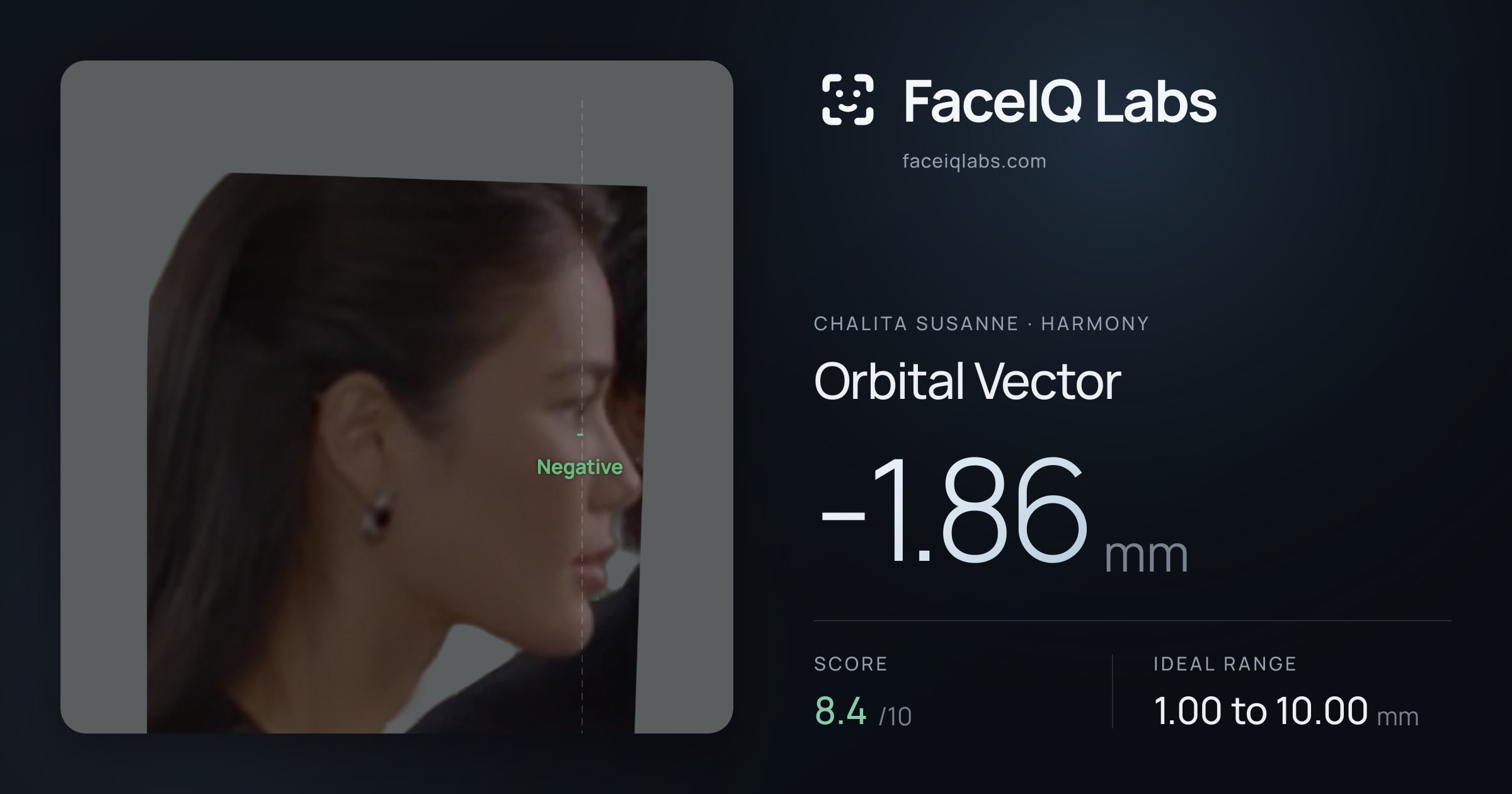 Chalita Susanne Orbital Vector: -1.86mm, drawn on the photo