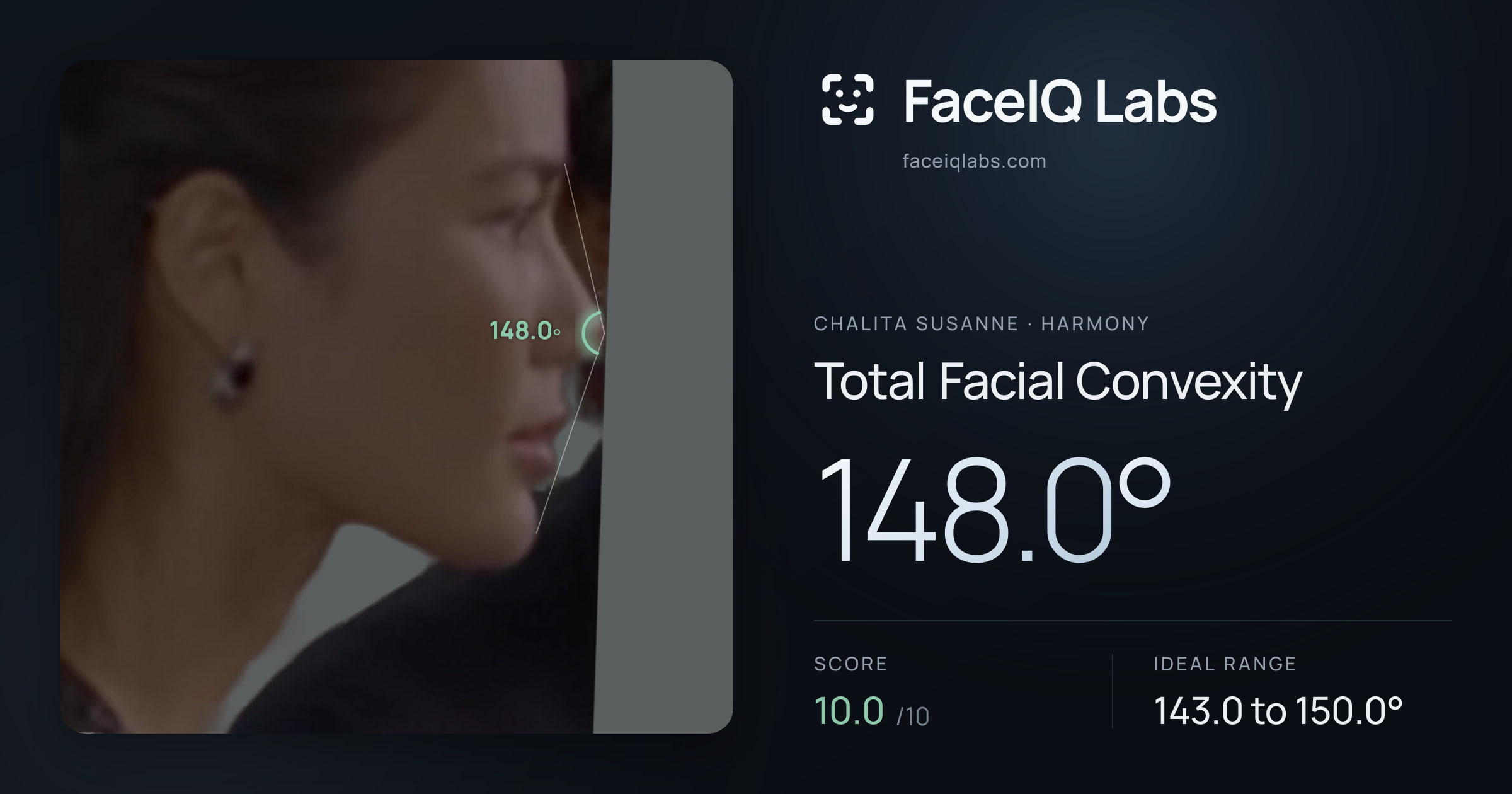 Chalita Susanne Total Facial Convexity: 148.0°, drawn on the photo