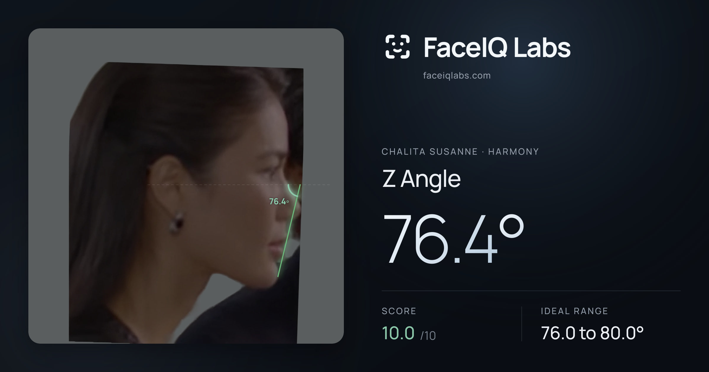 Chalita Susanne Z Angle: 76.4°, drawn on the photo