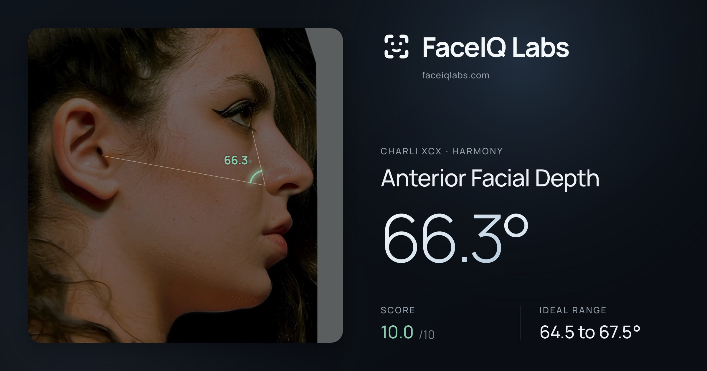 Charli XCX Anterior Facial Depth: 66.3°, drawn on the photo