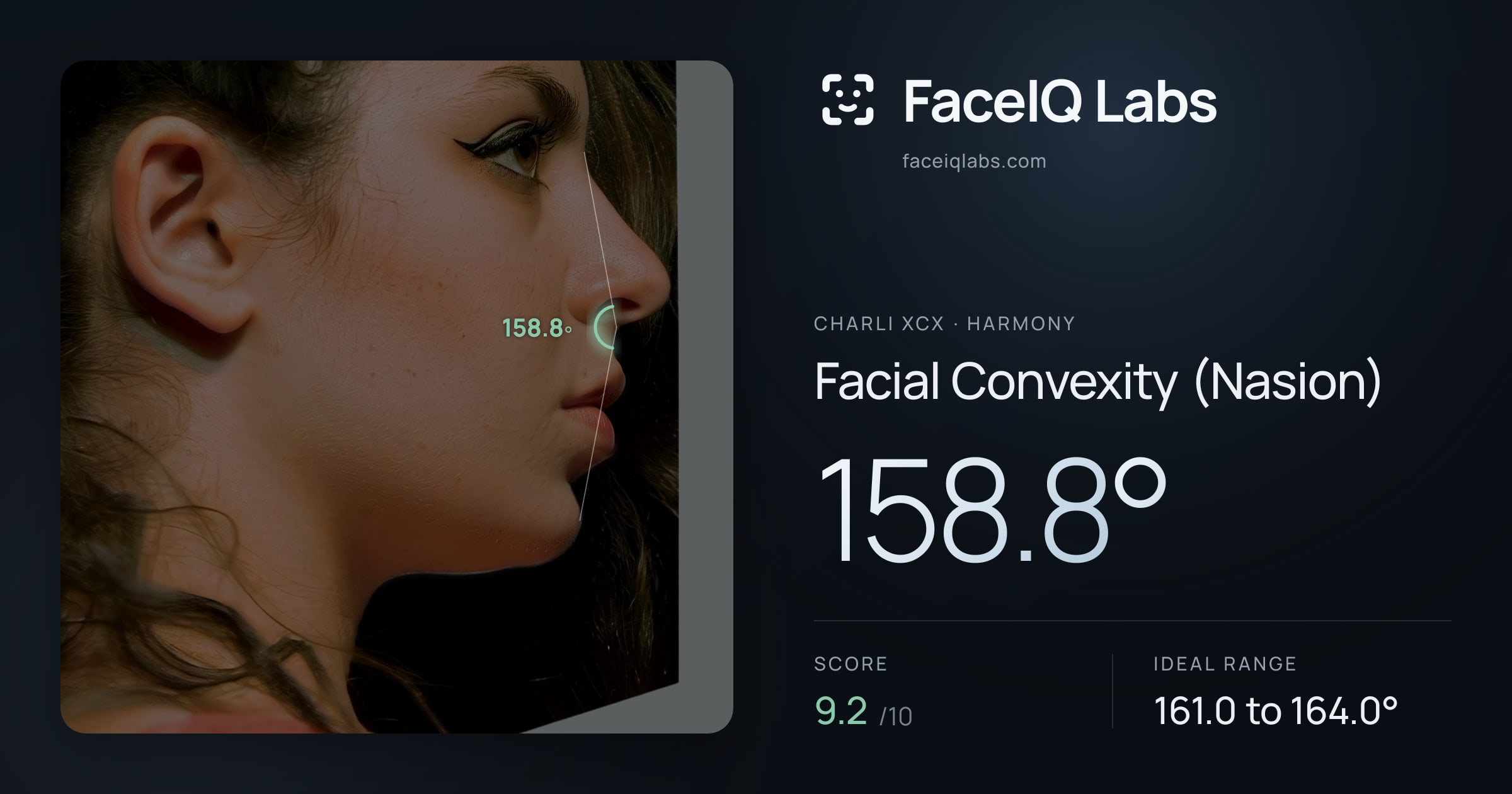 Charli XCX Facial Convexity (Nasion): 158.8°, drawn on the photo