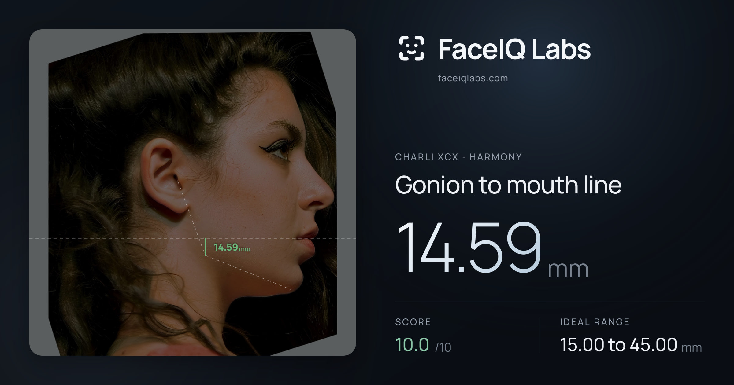 Charli XCX Gonion to mouth line: 14.59mm, drawn on the photo
