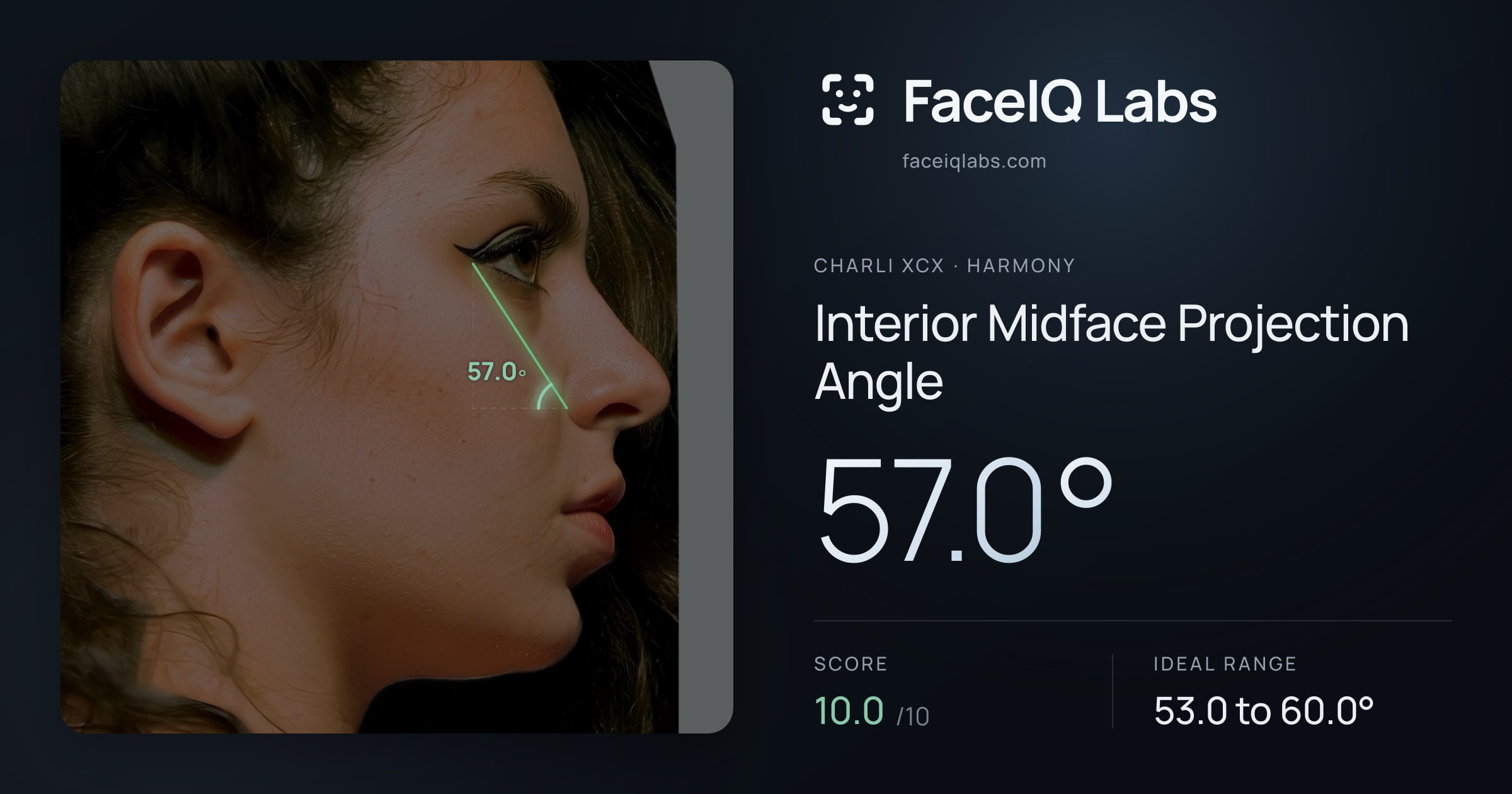 Charli XCX Interior Midface Projection Angle: 57.0°, drawn on the photo