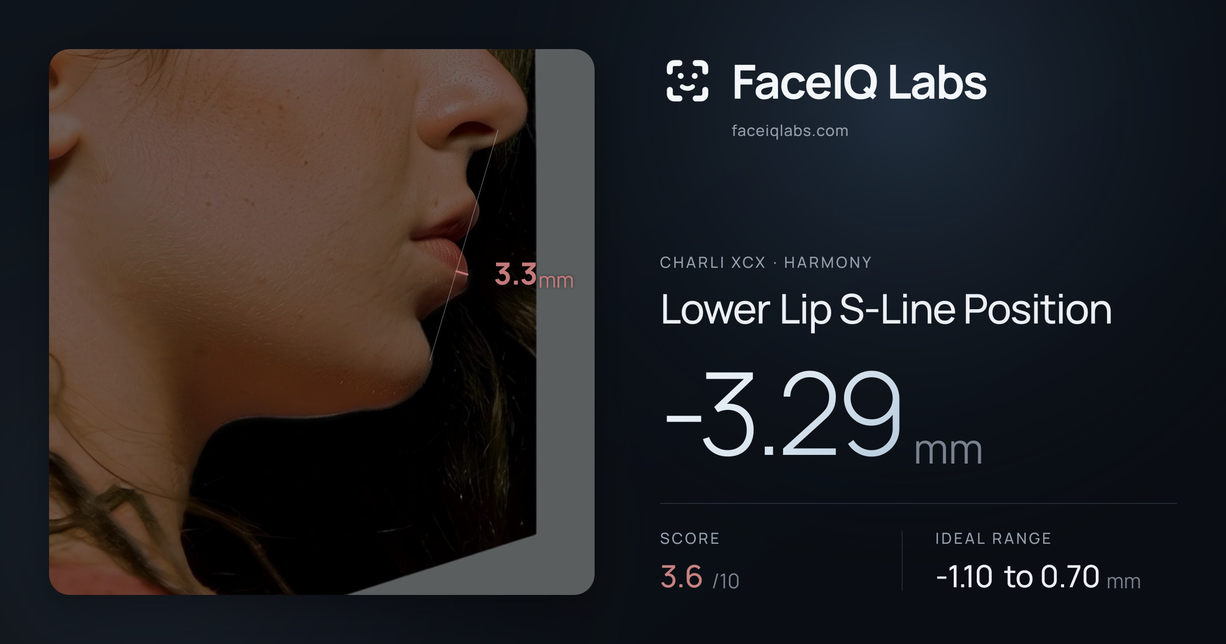 Charli XCX Lower Lip S-Line Position: -3.29mm, drawn on the photo