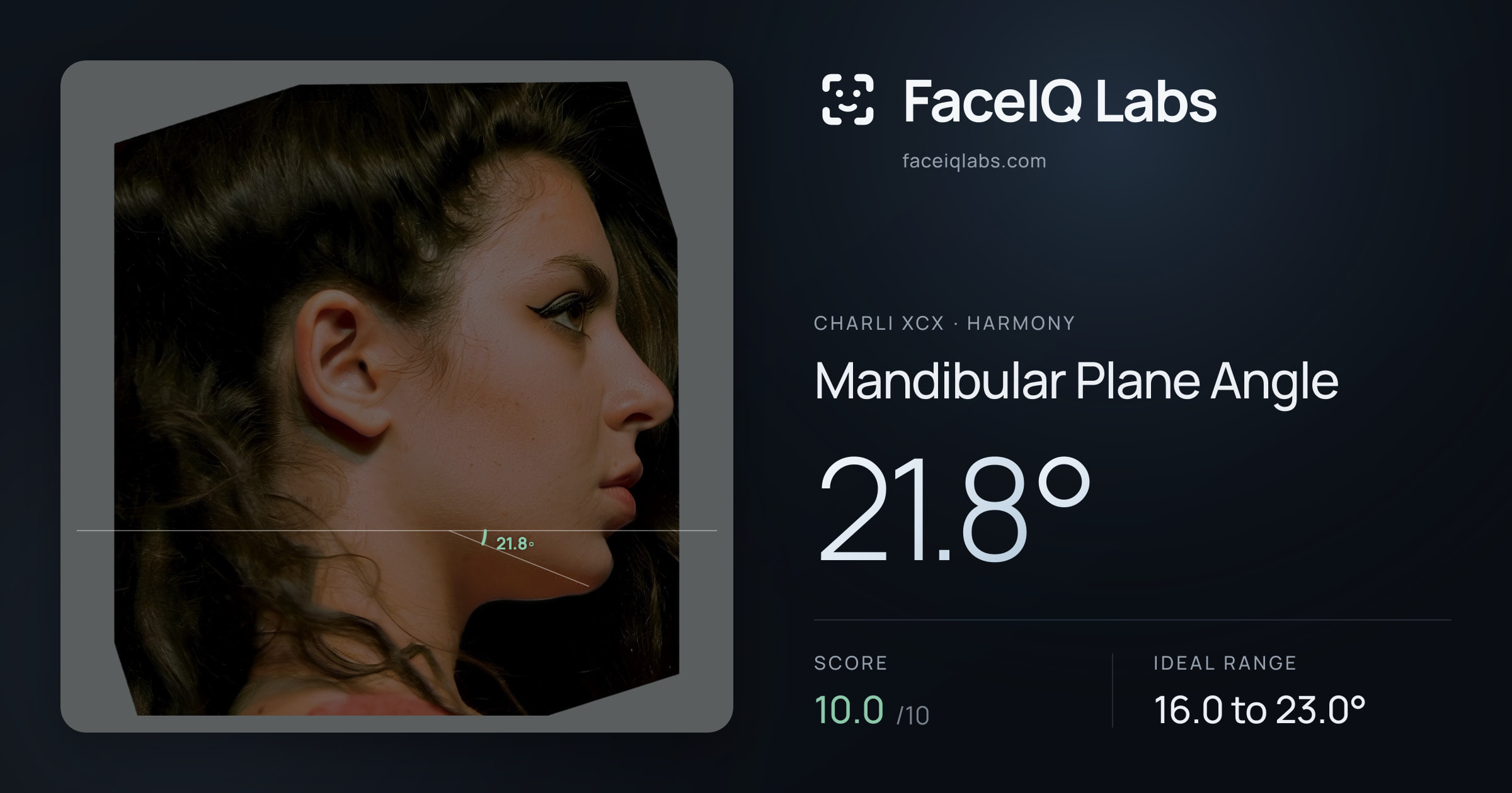 Charli XCX Mandibular Plane Angle: 21.8°, drawn on the photo