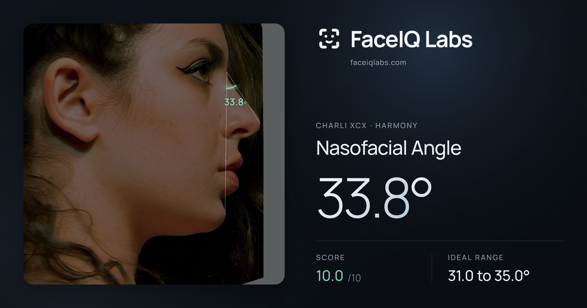 Charli XCX Nasofacial Angle: 33.8°, drawn on the photo