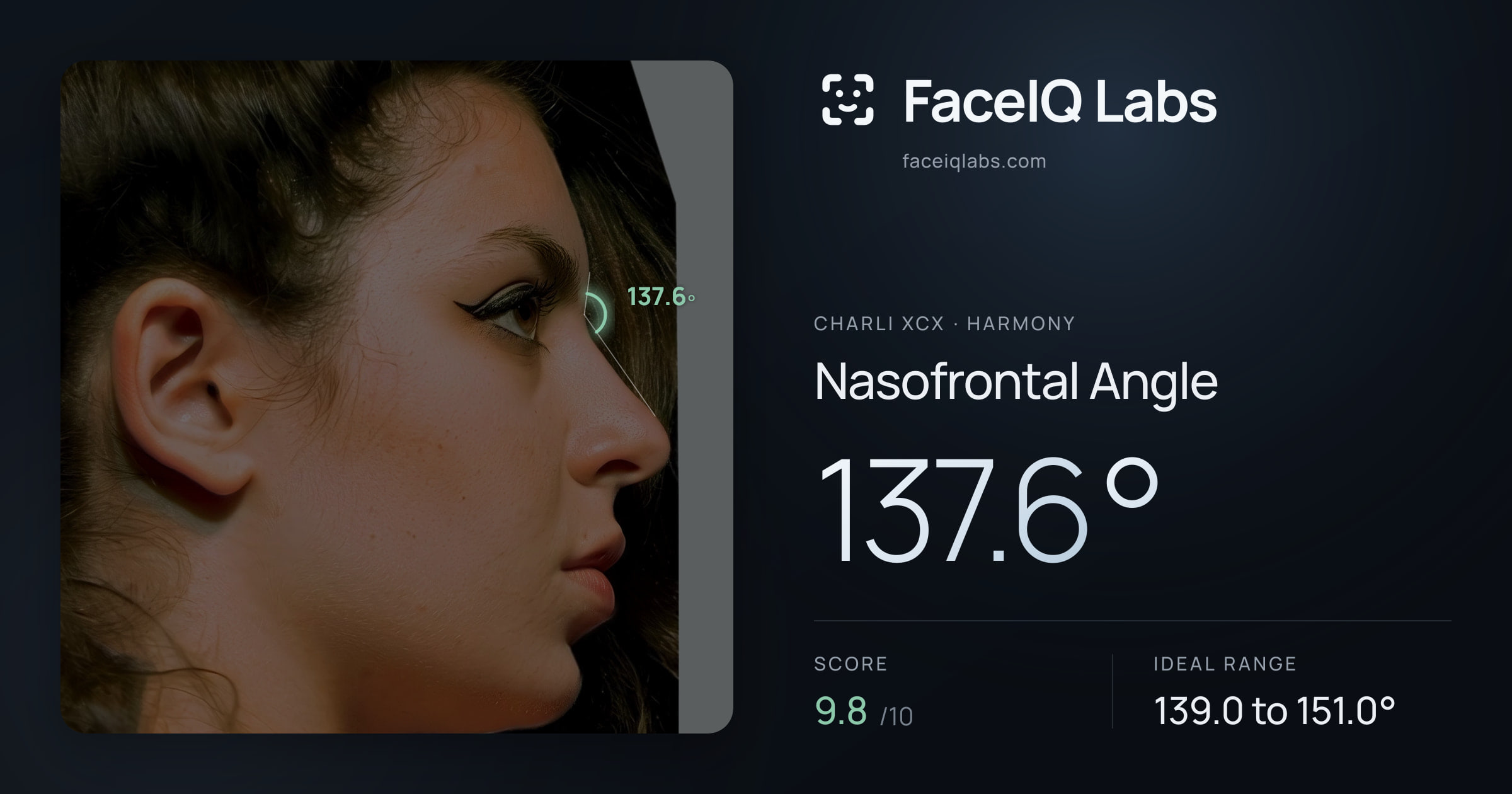 Charli XCX Nasofrontal Angle: 137.6°, drawn on the photo