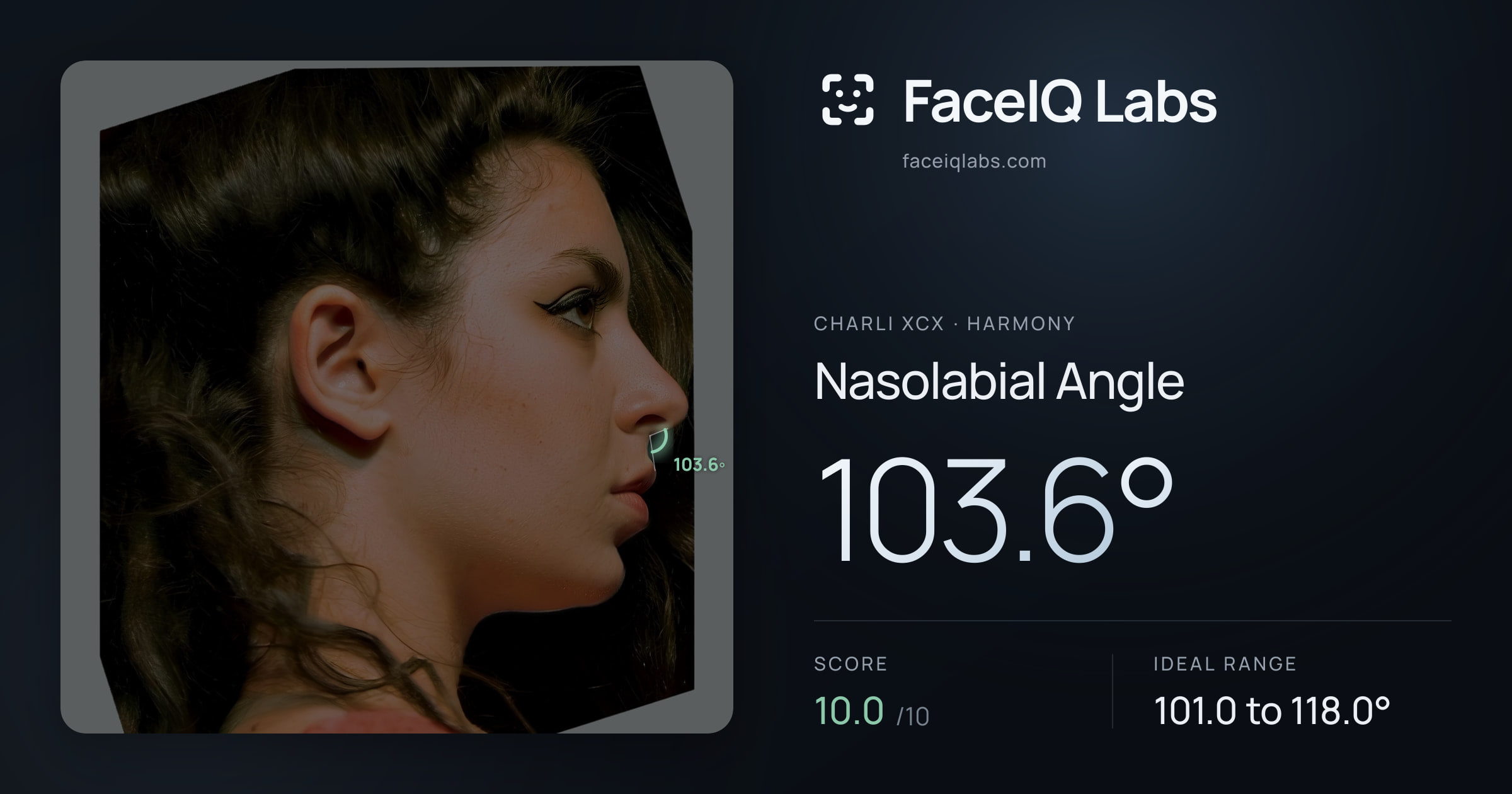 Charli XCX Nasolabial Angle: 103.6°, drawn on the photo