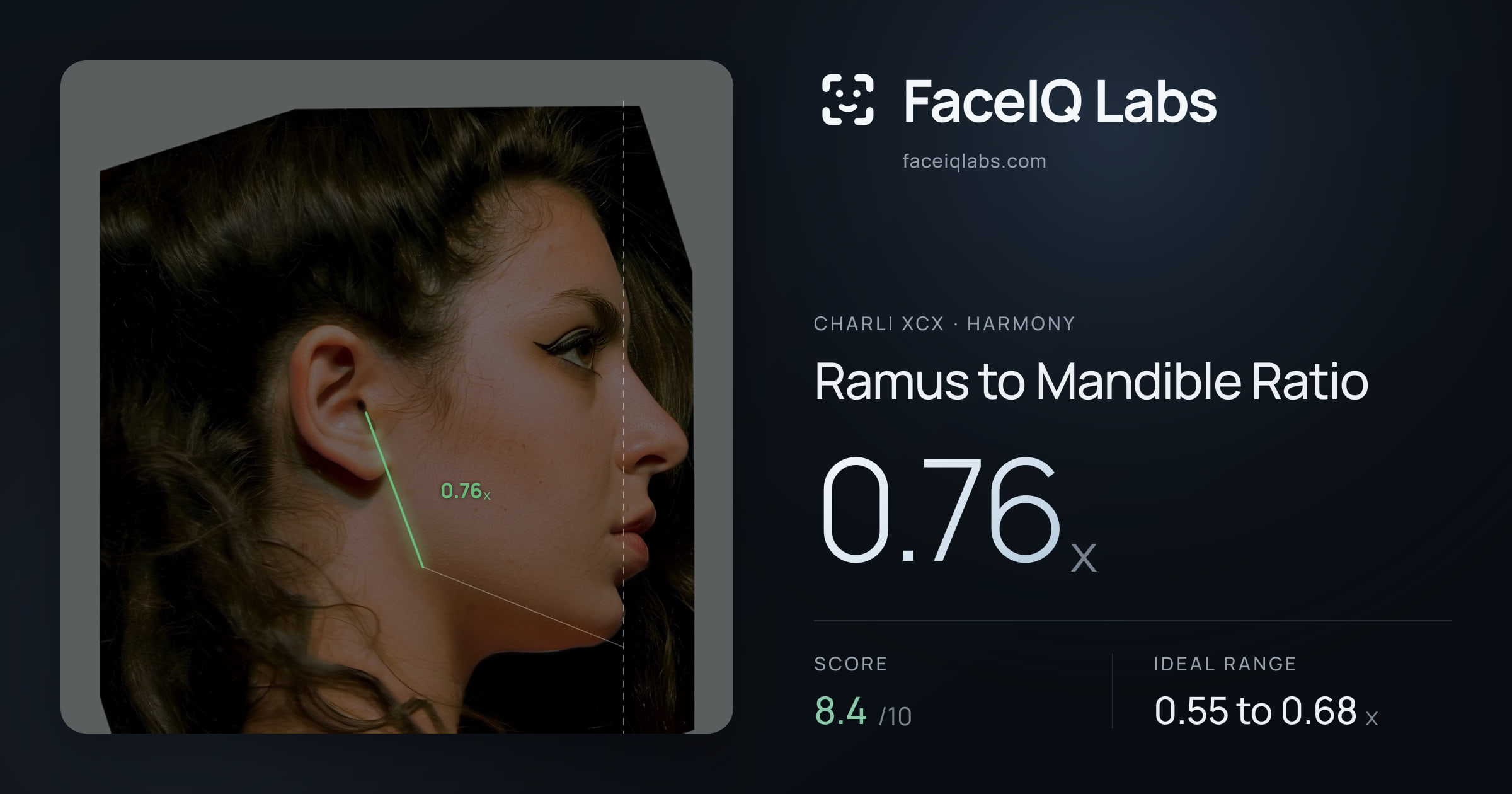 Charli XCX Ramus to Mandible Ratio: 0.76x, drawn on the photo
