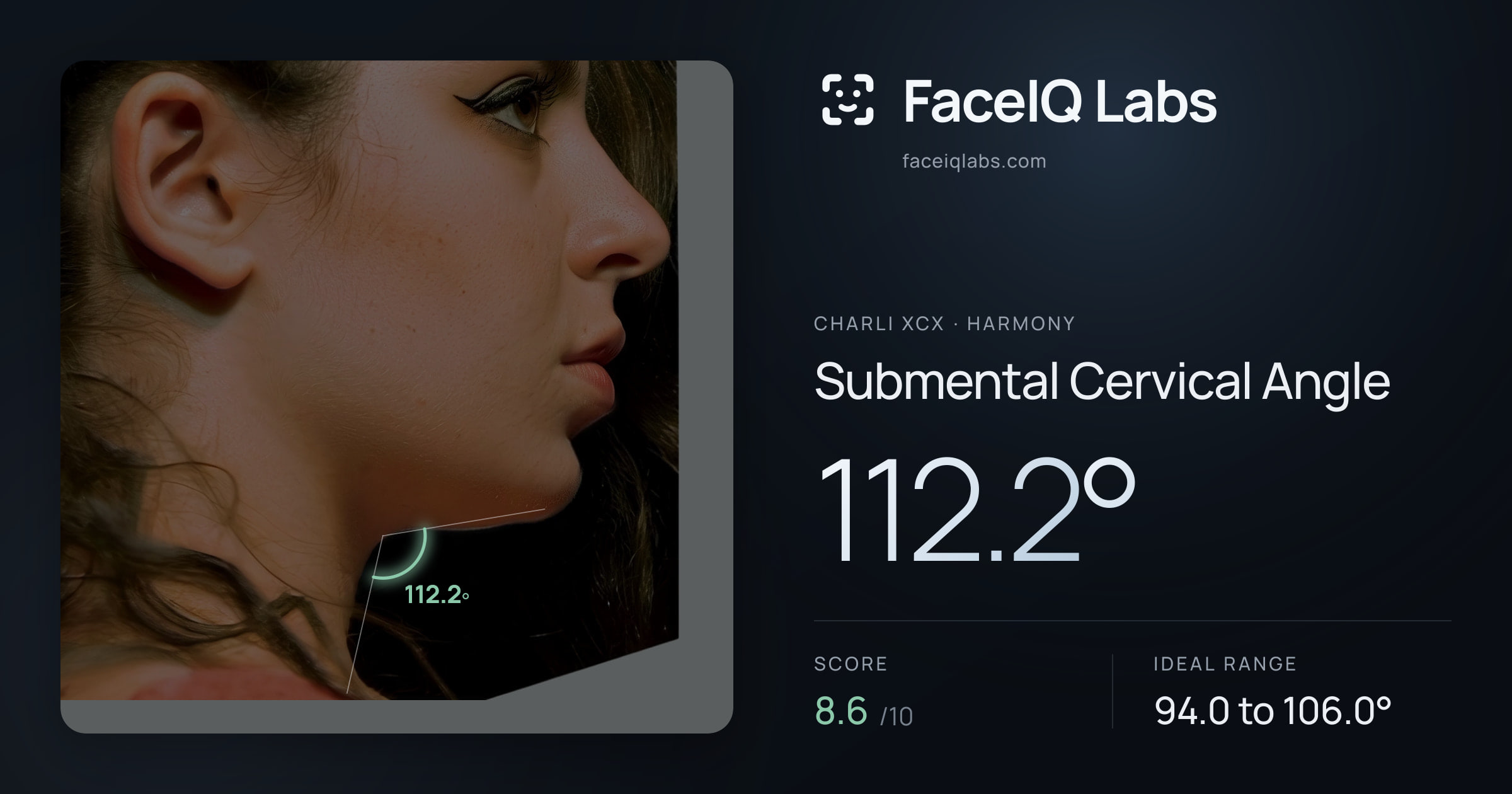 Charli XCX Submental Cervical Angle: 112.2°, drawn on the photo