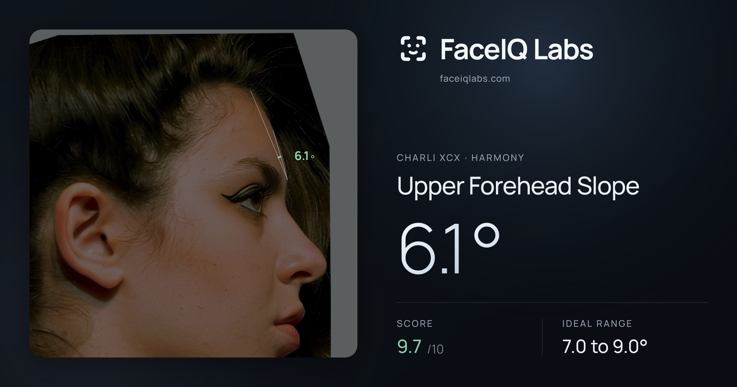 Charli XCX Upper Forehead Slope: 6.1°, drawn on the photo