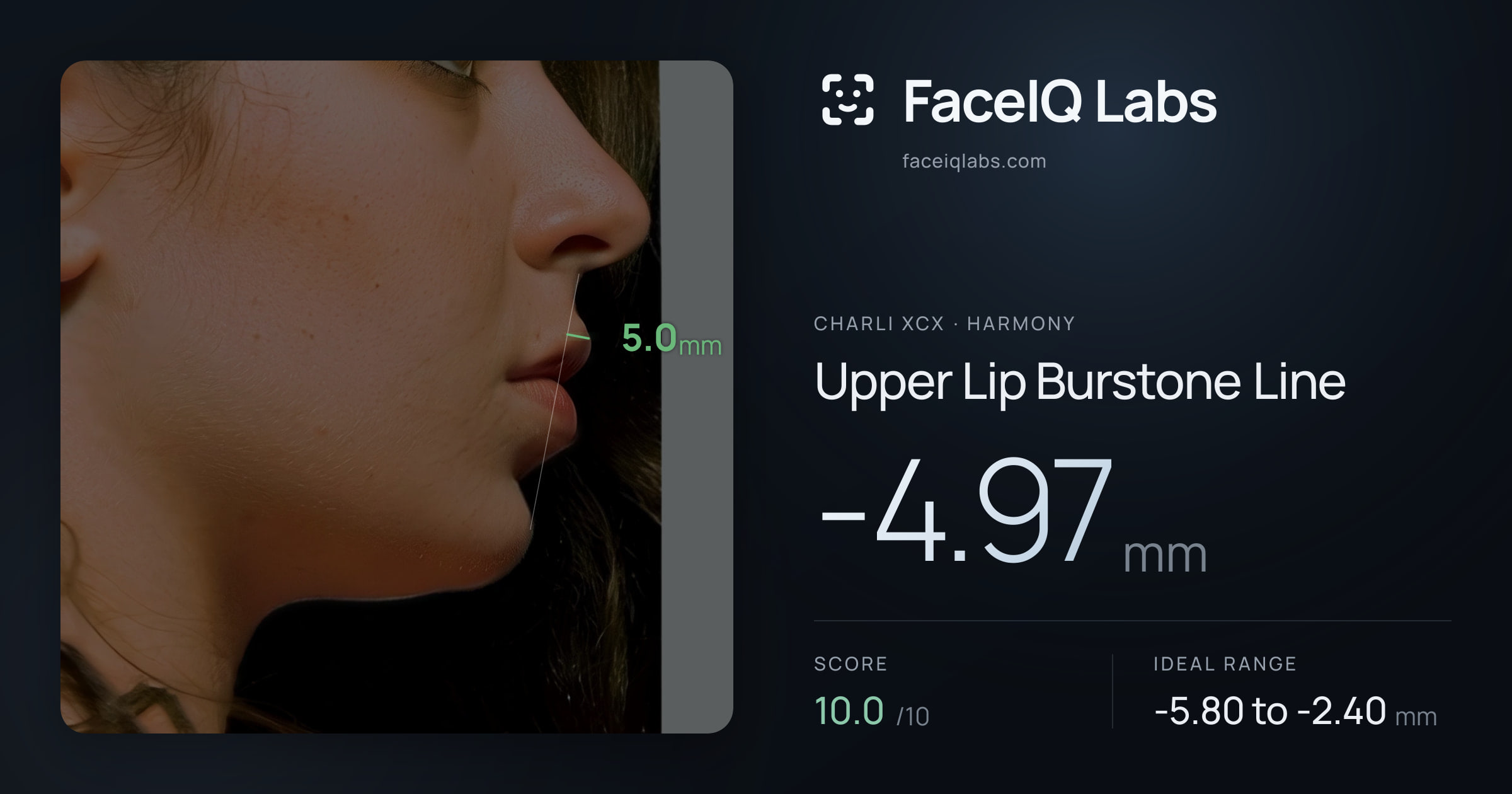 Charli XCX Upper Lip Burstone Line: -4.97mm, drawn on the photo