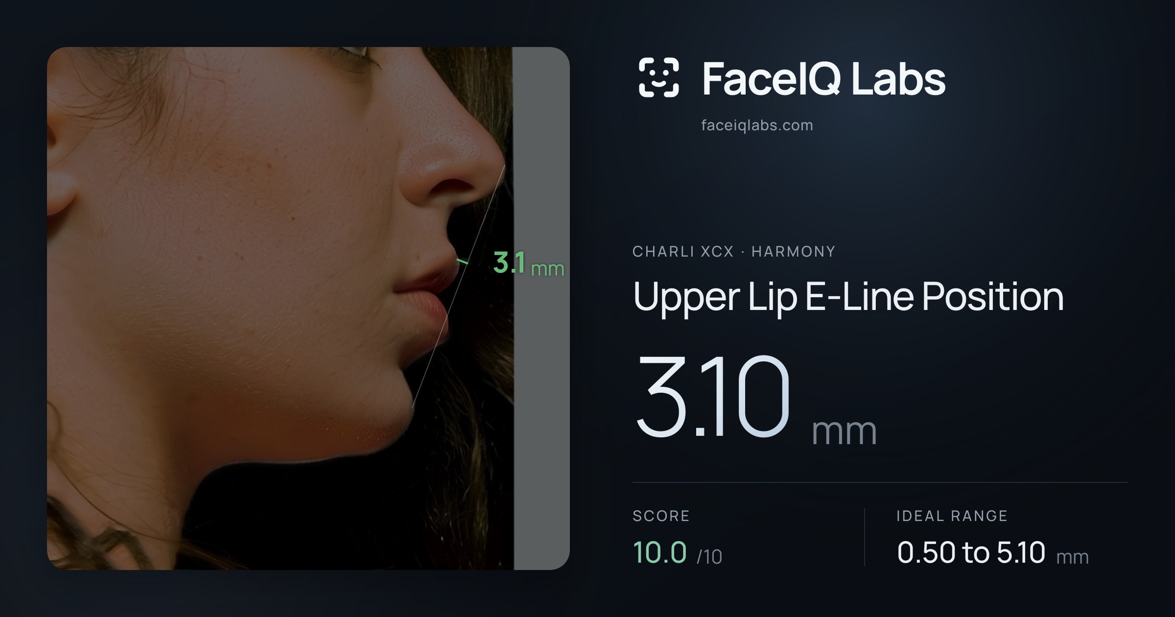 Charli XCX Upper Lip E-Line Position: 3.10mm, drawn on the photo