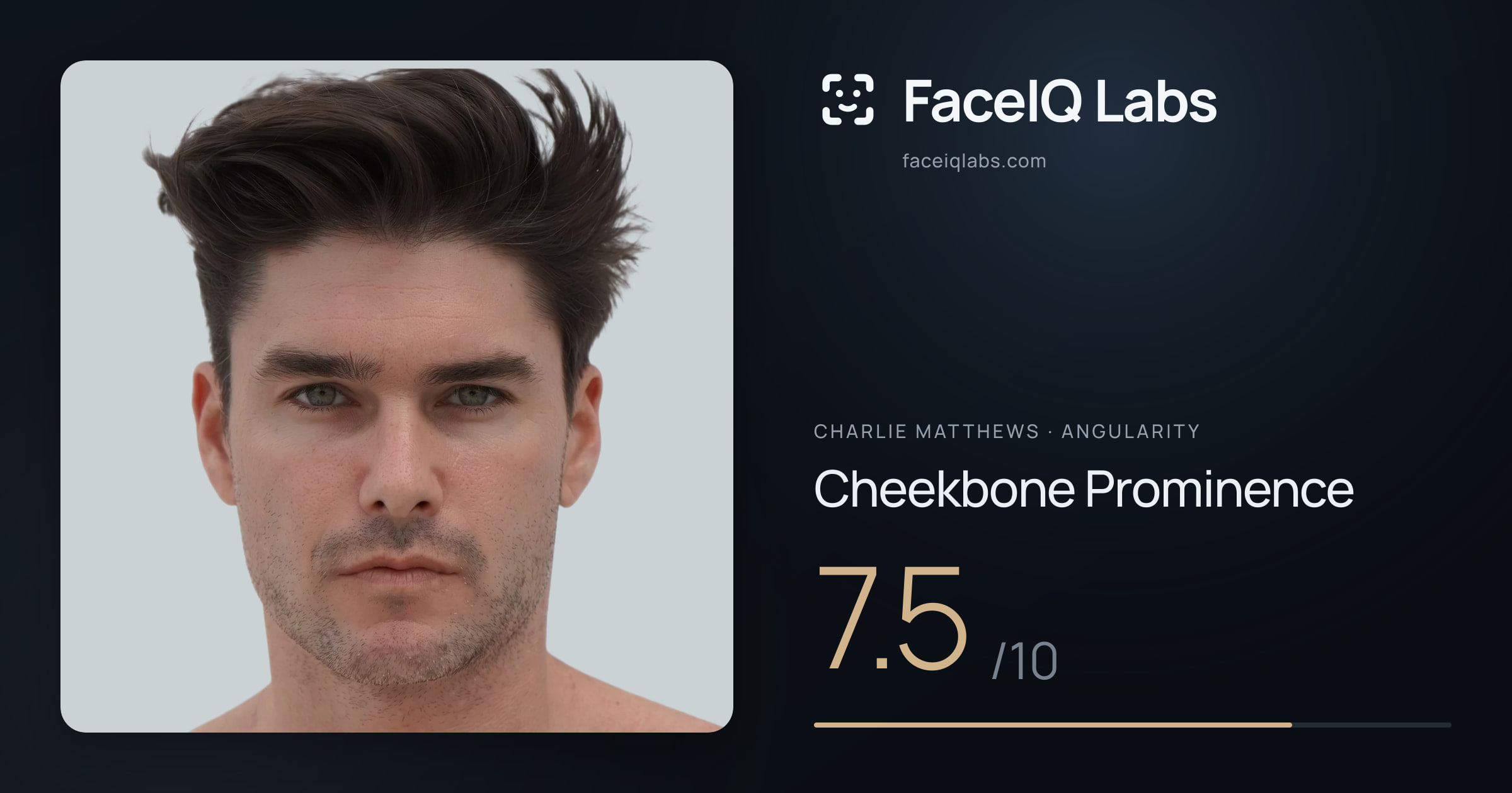 Charlie Matthews Cheekbone Prominence: 7.5/10, drawn on the photo