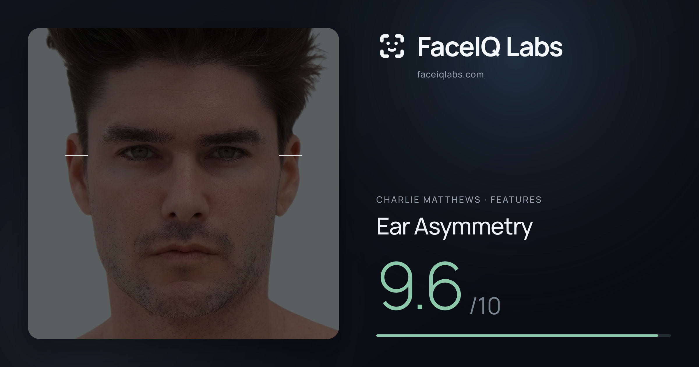 Charlie Matthews Ear Asymmetry: 9.6/10, drawn on the photo