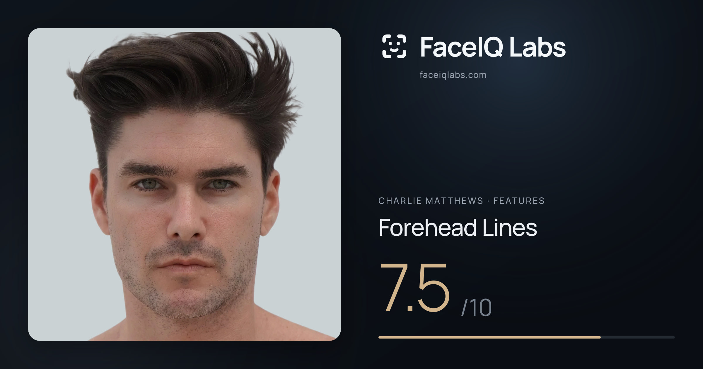 Charlie Matthews Forehead Lines: 7.5/10, drawn on the photo