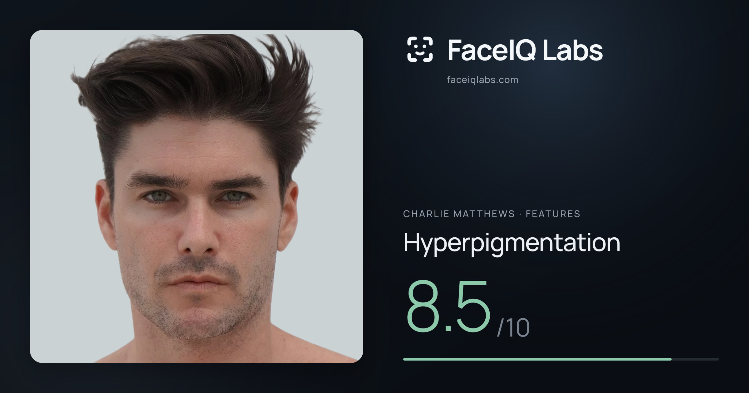 Charlie Matthews Hyperpigmentation: 8.5/10, drawn on the photo