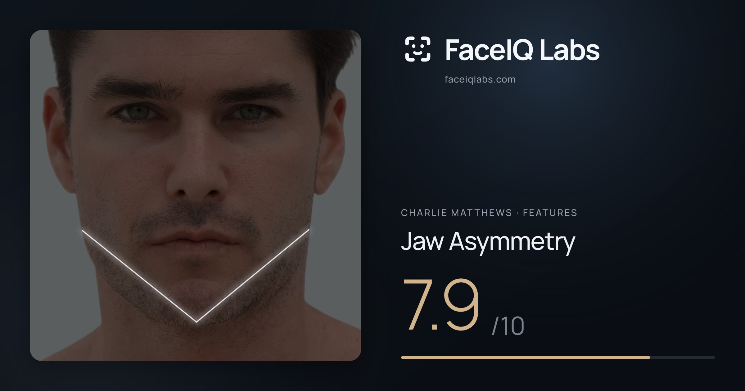 Charlie Matthews Jaw Asymmetry: 7.9/10, drawn on the photo