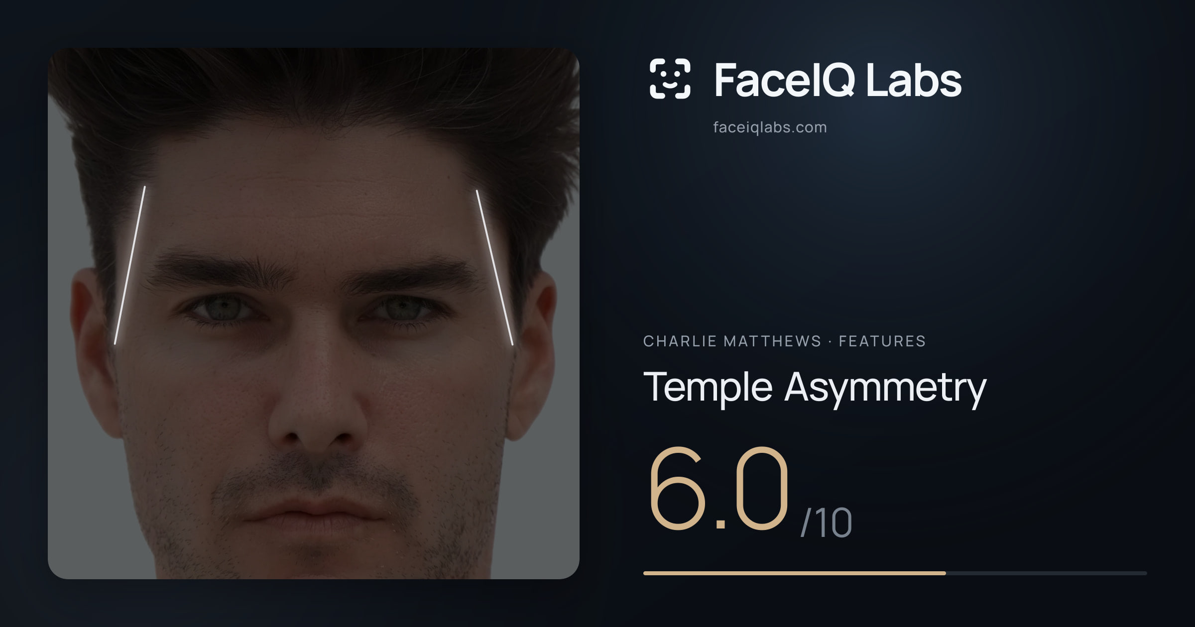 Charlie Matthews Temple Asymmetry: 6.0/10, drawn on the photo