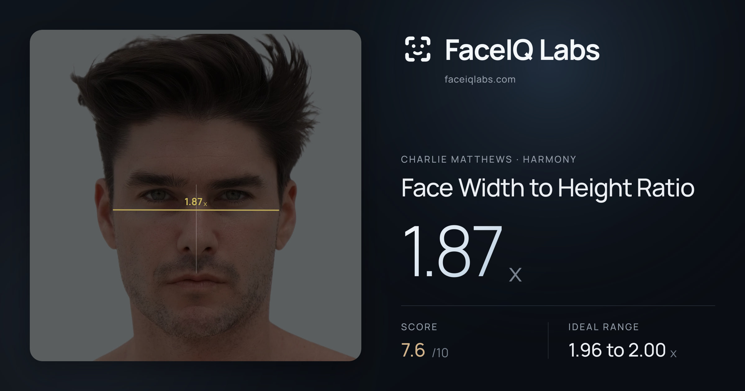 Charlie Matthews Face Width to Height Ratio: 1.87x, drawn on the photo
