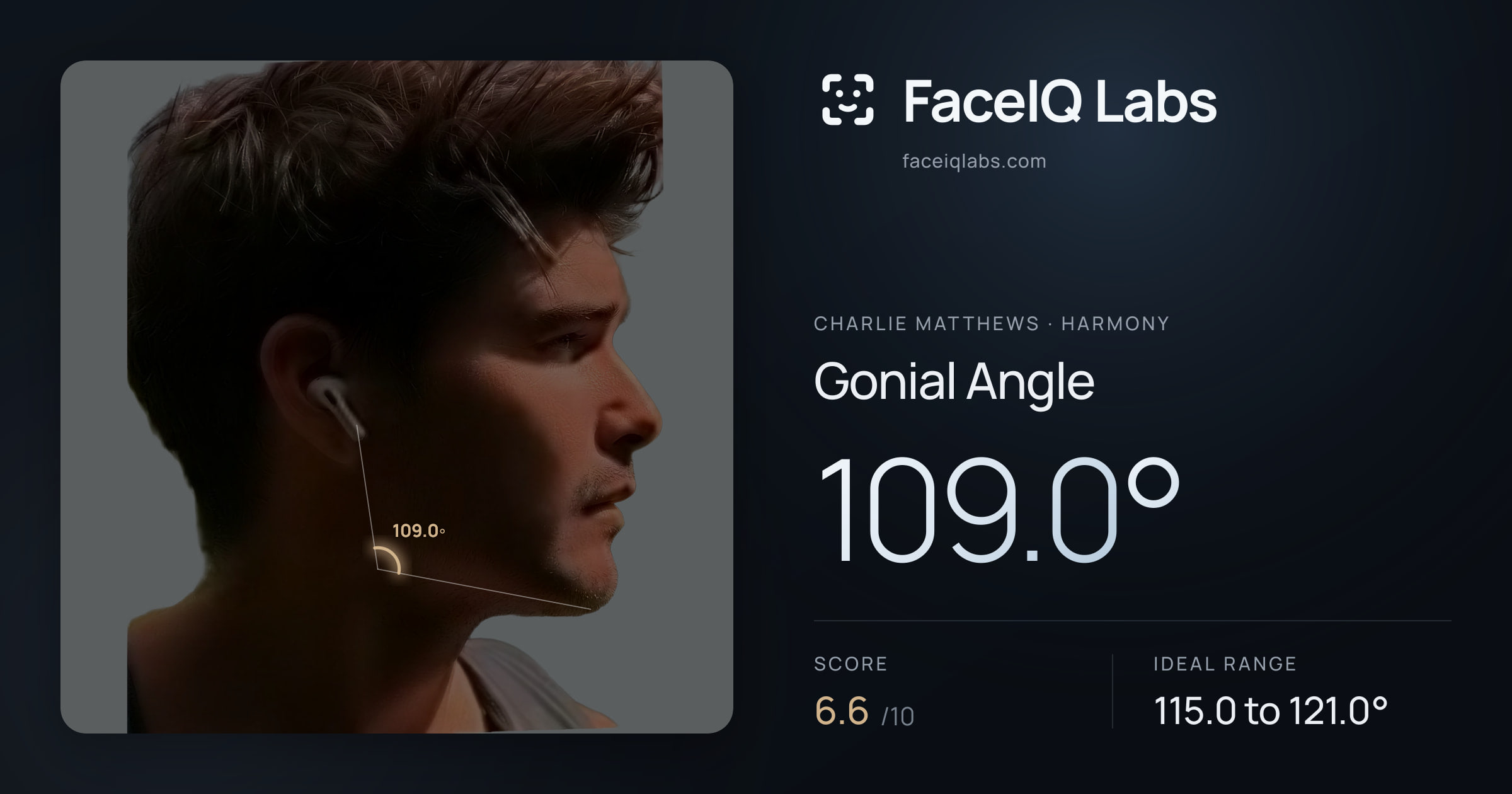 Charlie Matthews Gonial Angle: 109.0°, drawn on the photo