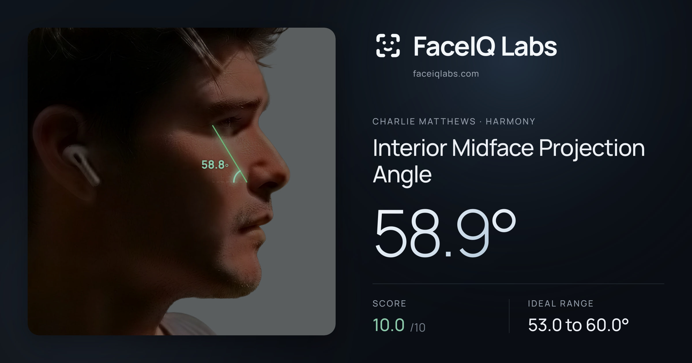 Charlie Matthews Interior Midface Projection Angle: 58.9°, drawn on the photo