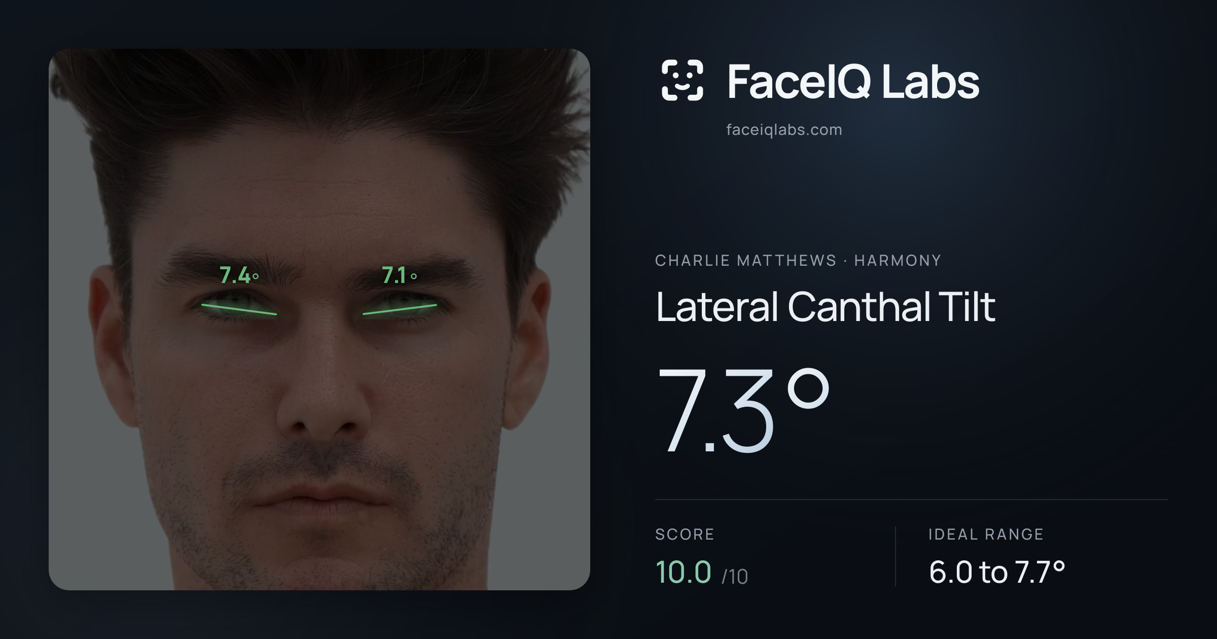Charlie Matthews Lateral Canthal Tilt: 7.3°, drawn on the photo