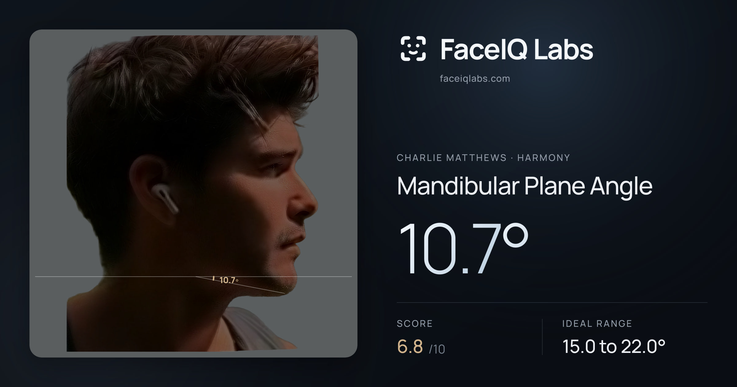 Charlie Matthews Mandibular Plane Angle: 10.7°, drawn on the photo