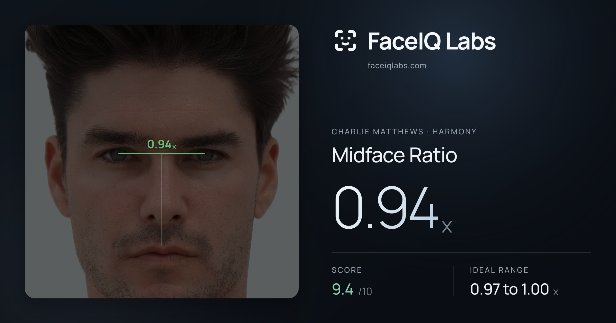 Charlie Matthews Midface Ratio: 0.94x, drawn on the photo