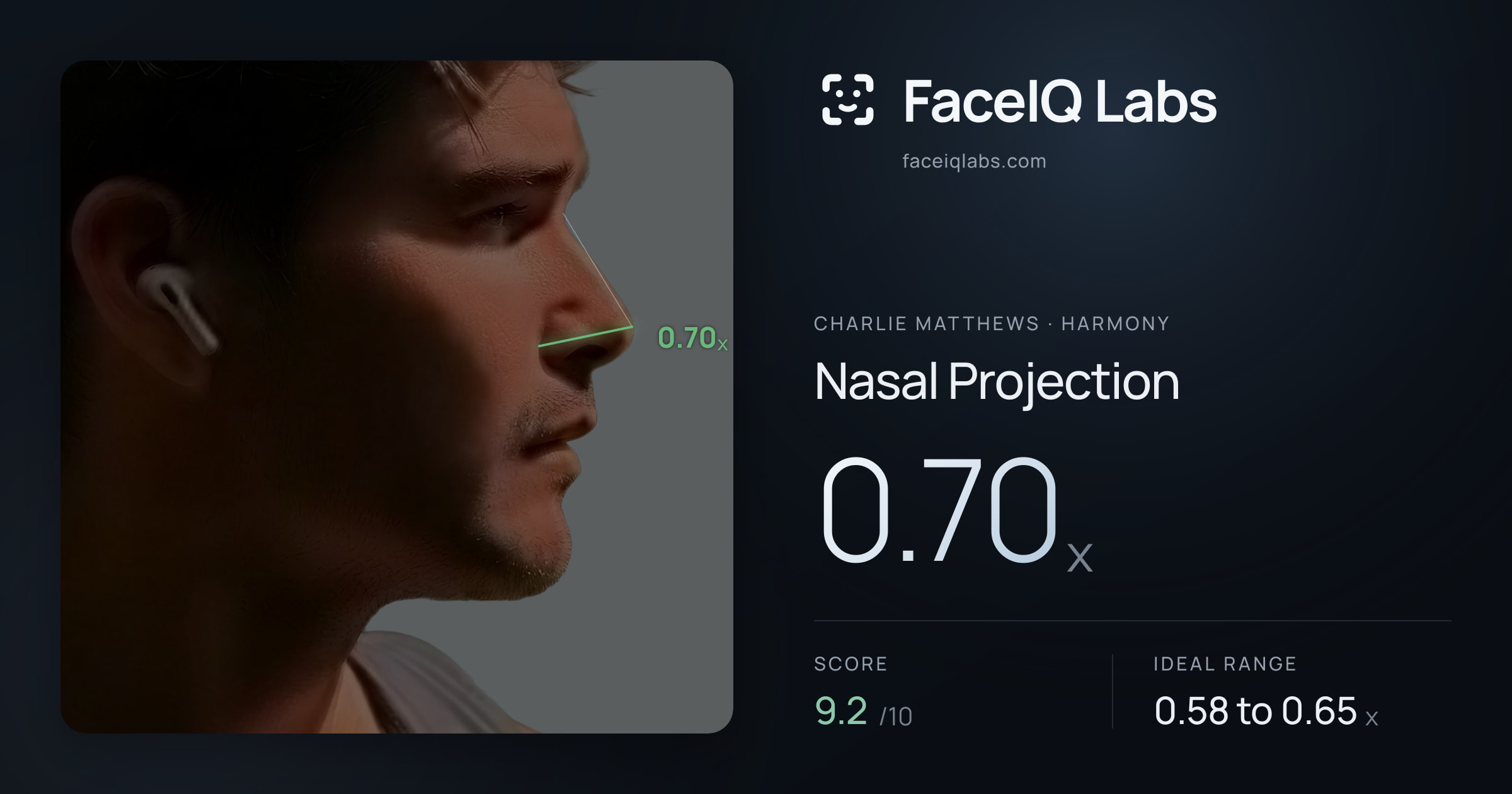 Charlie Matthews Nasal Projection: 0.70x, drawn on the photo