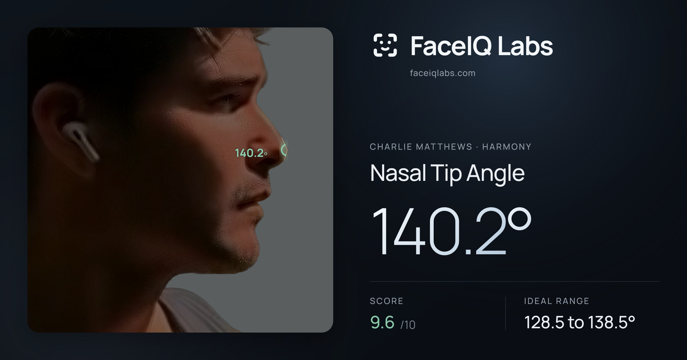 Charlie Matthews Nasal Tip Angle: 140.2°, drawn on the photo