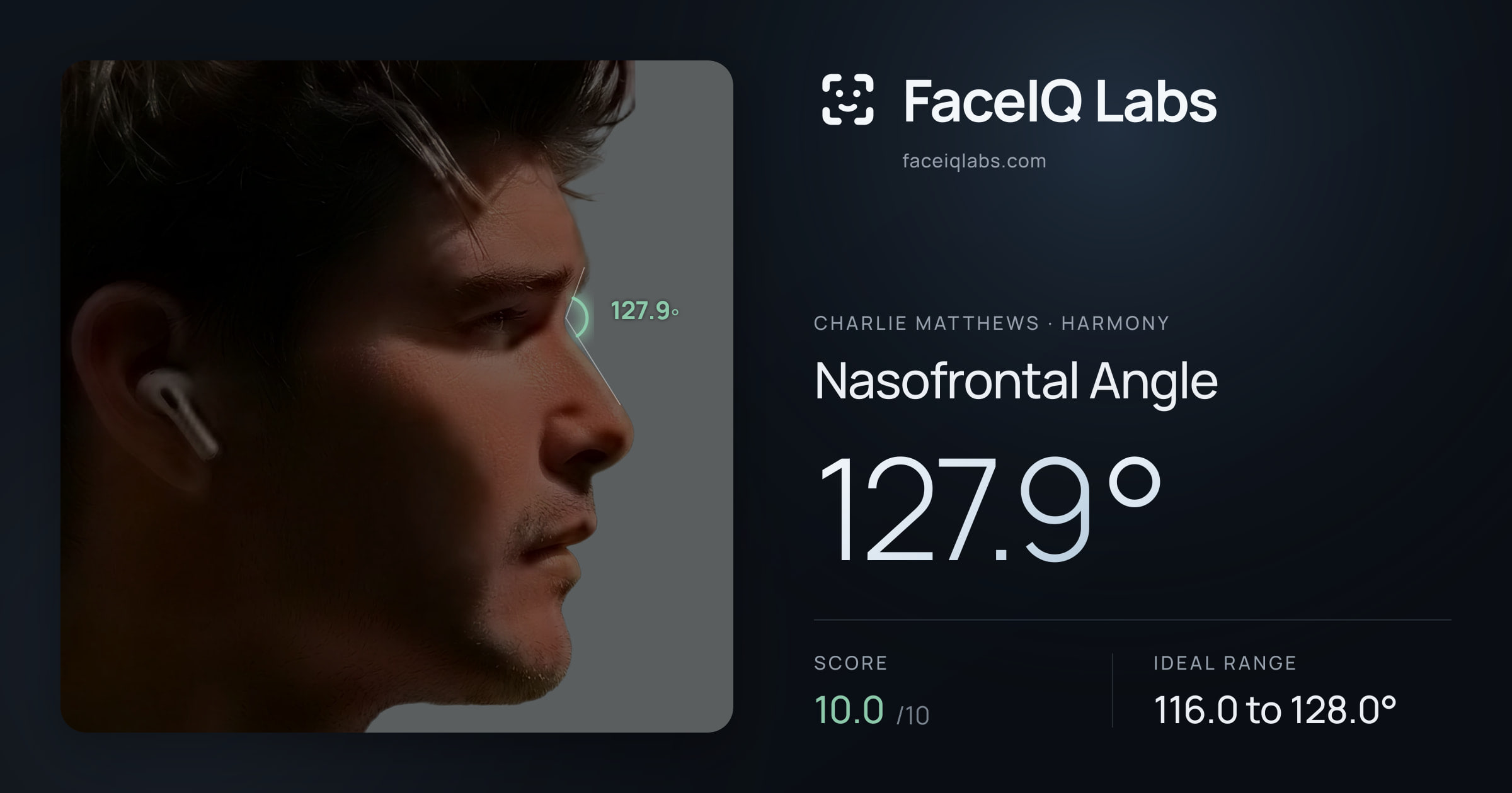 Charlie Matthews Nasofrontal Angle: 127.9°, drawn on the photo