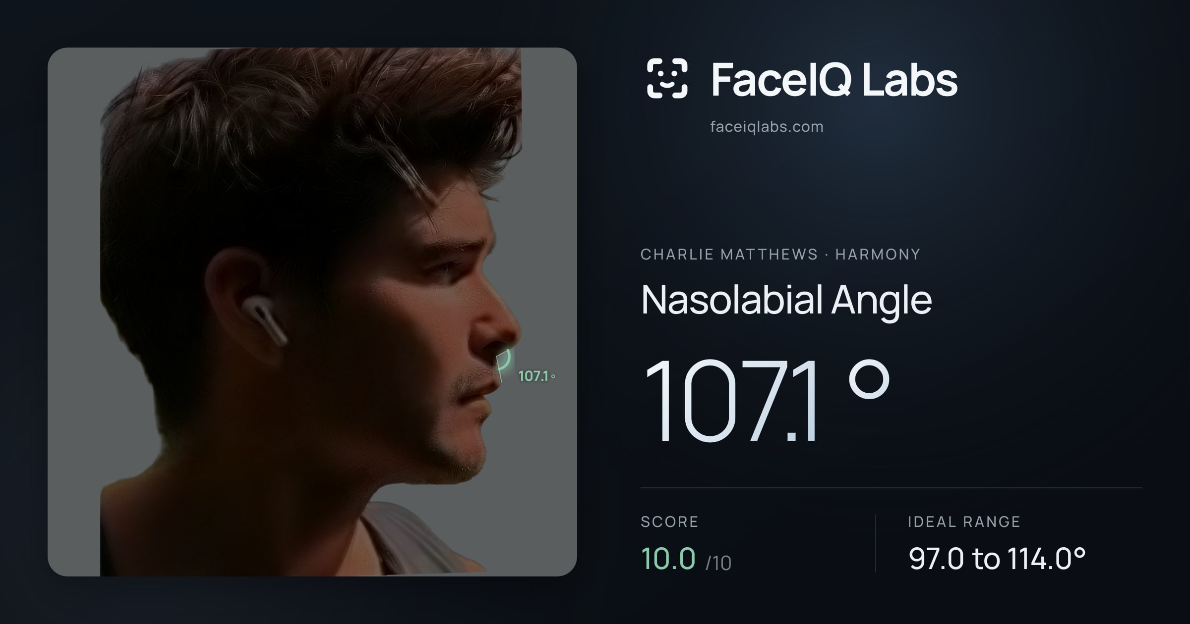Charlie Matthews Nasolabial Angle: 107.1°, drawn on the photo