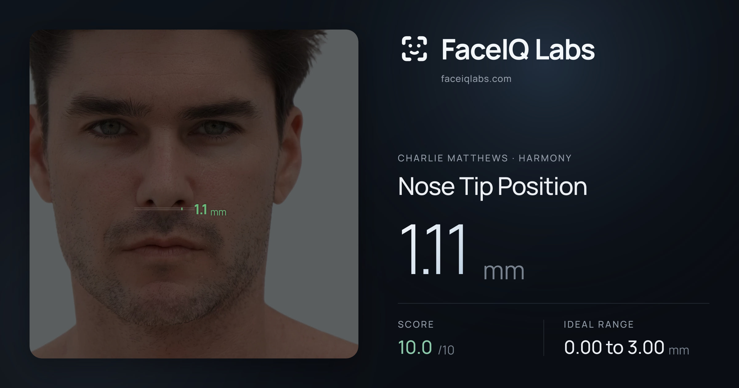 Charlie Matthews Nose Tip Position: 1.11mm, drawn on the photo