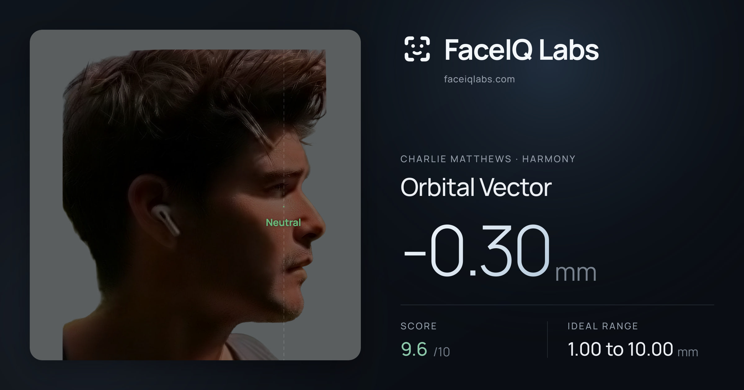 Charlie Matthews Orbital Vector: -0.30mm, drawn on the photo