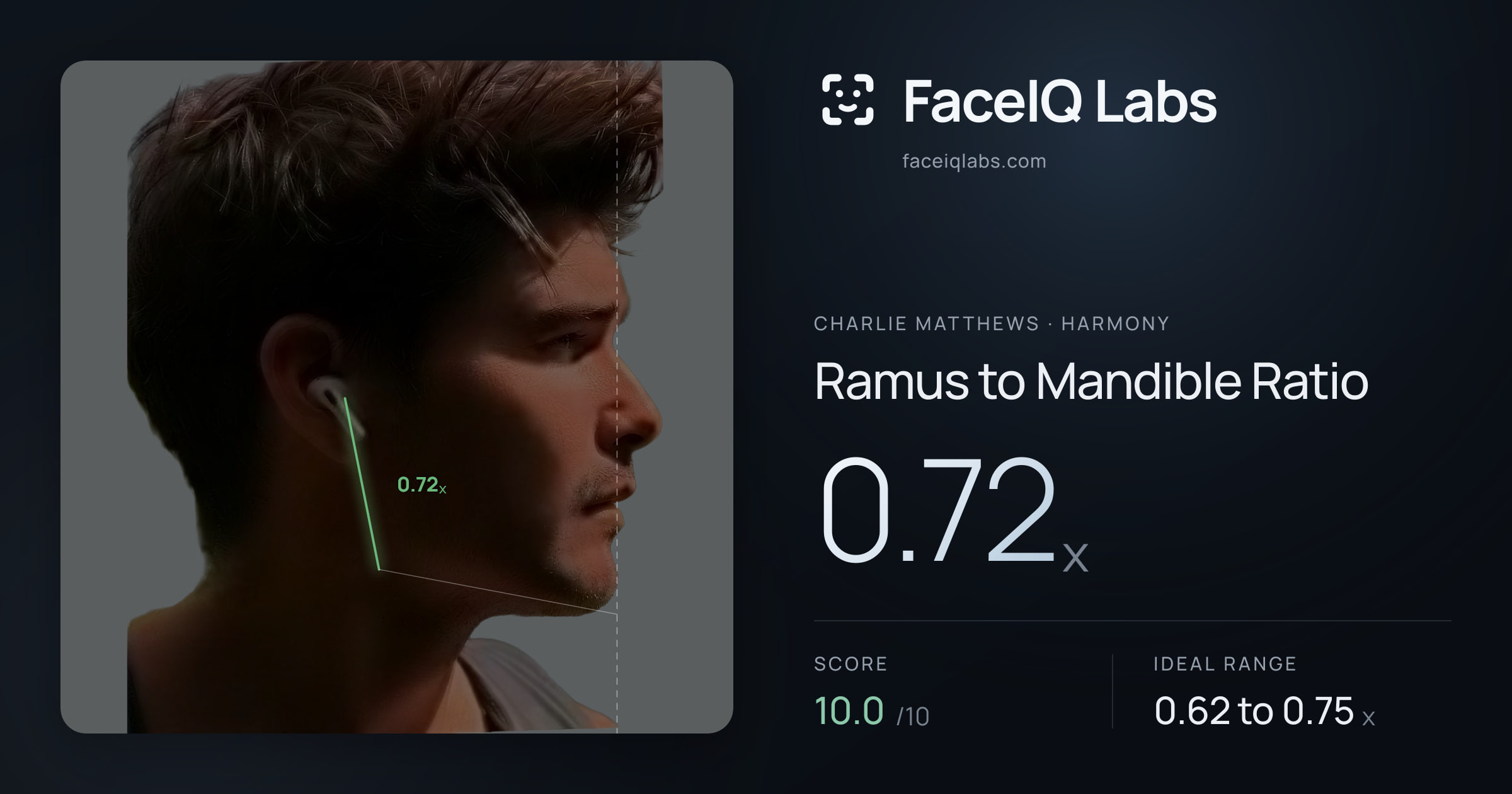 Charlie Matthews Ramus to Mandible Ratio: 0.72x, drawn on the photo