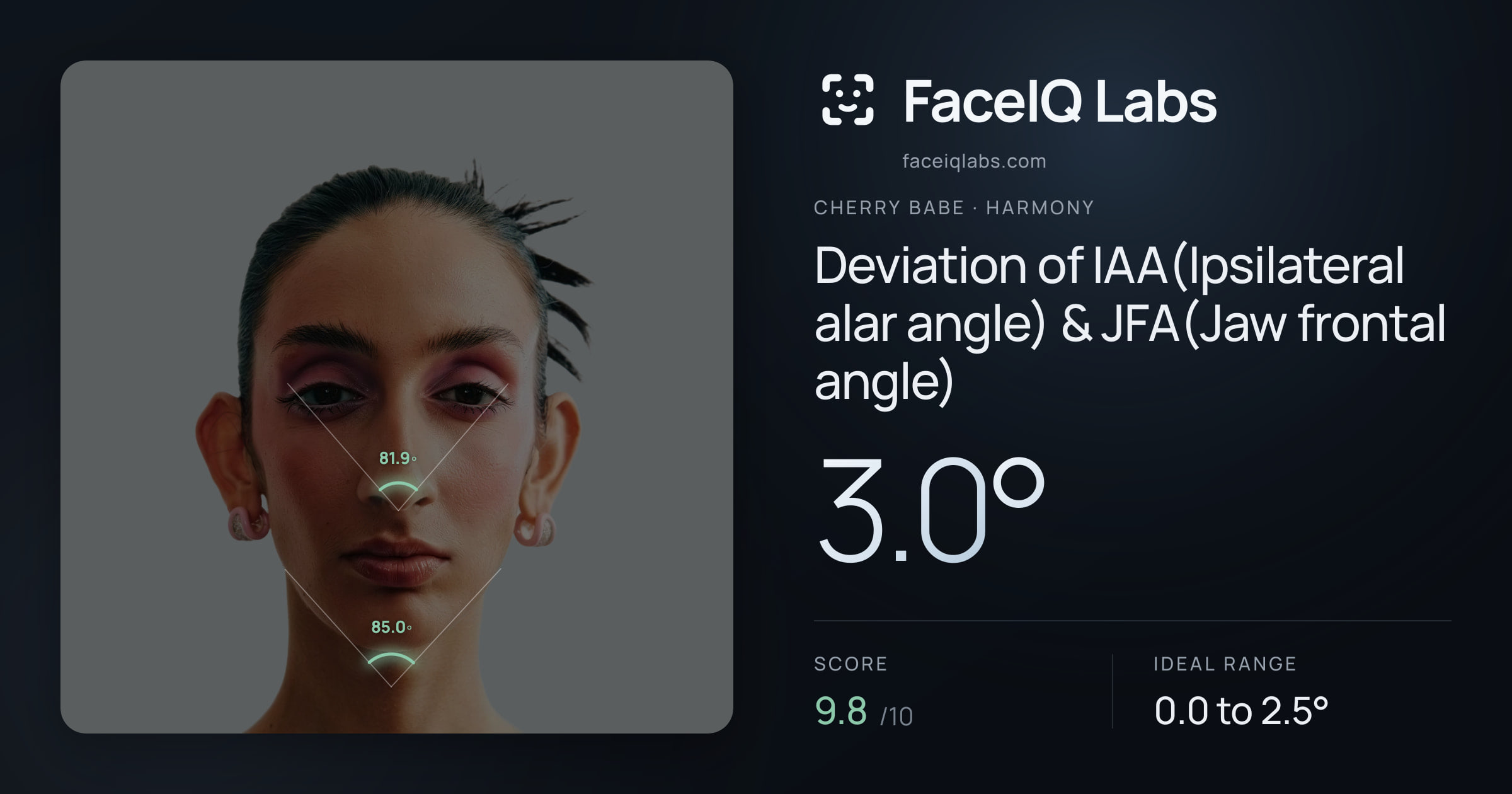Cherry Babe Deviation of IAA(Ipsilateral alar angle) & JFA(Jaw frontal angle): 3.0°, drawn on the photo