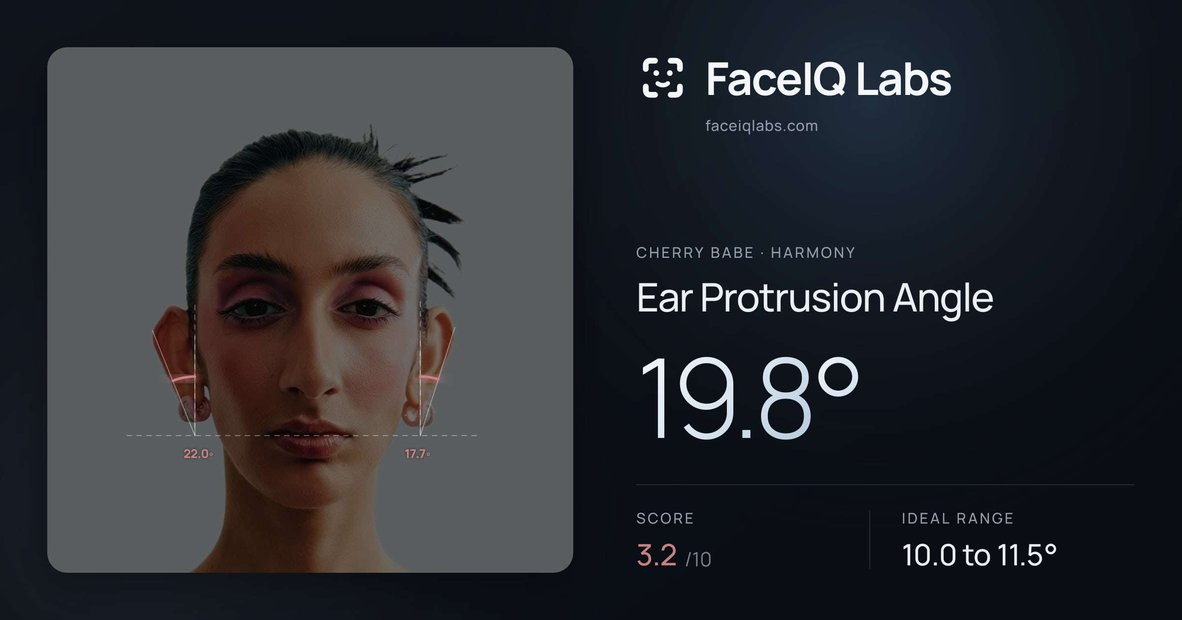 Cherry Babe Ear Protrusion Angle: 19.8°, drawn on the photo