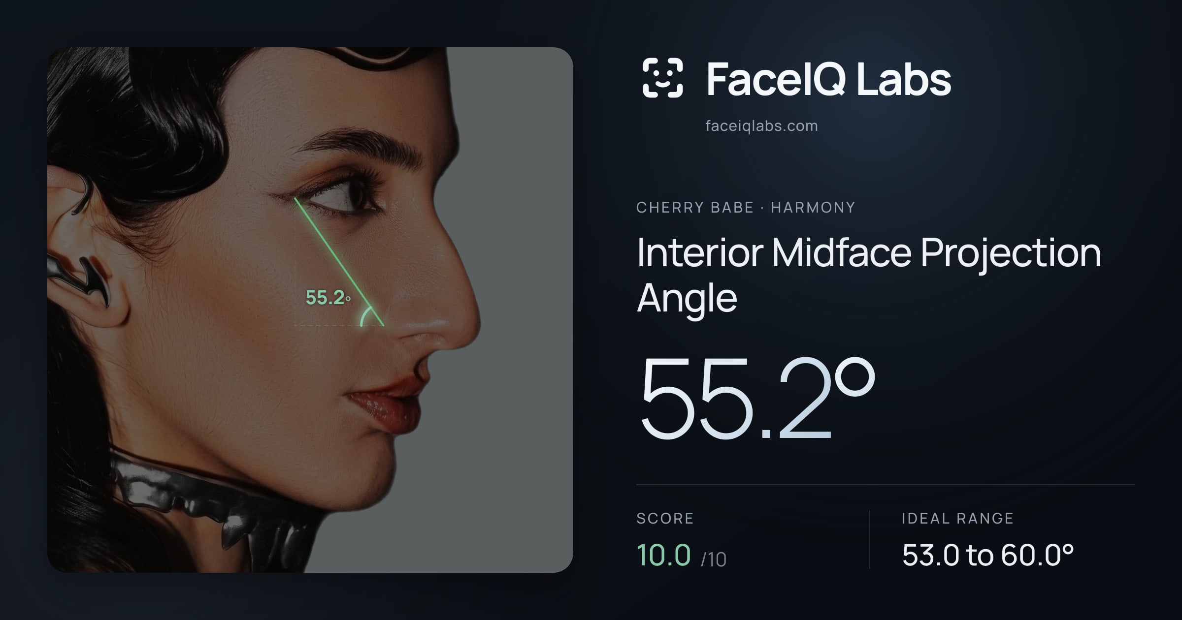 Cherry Babe Interior Midface Projection Angle: 55.2°, drawn on the photo